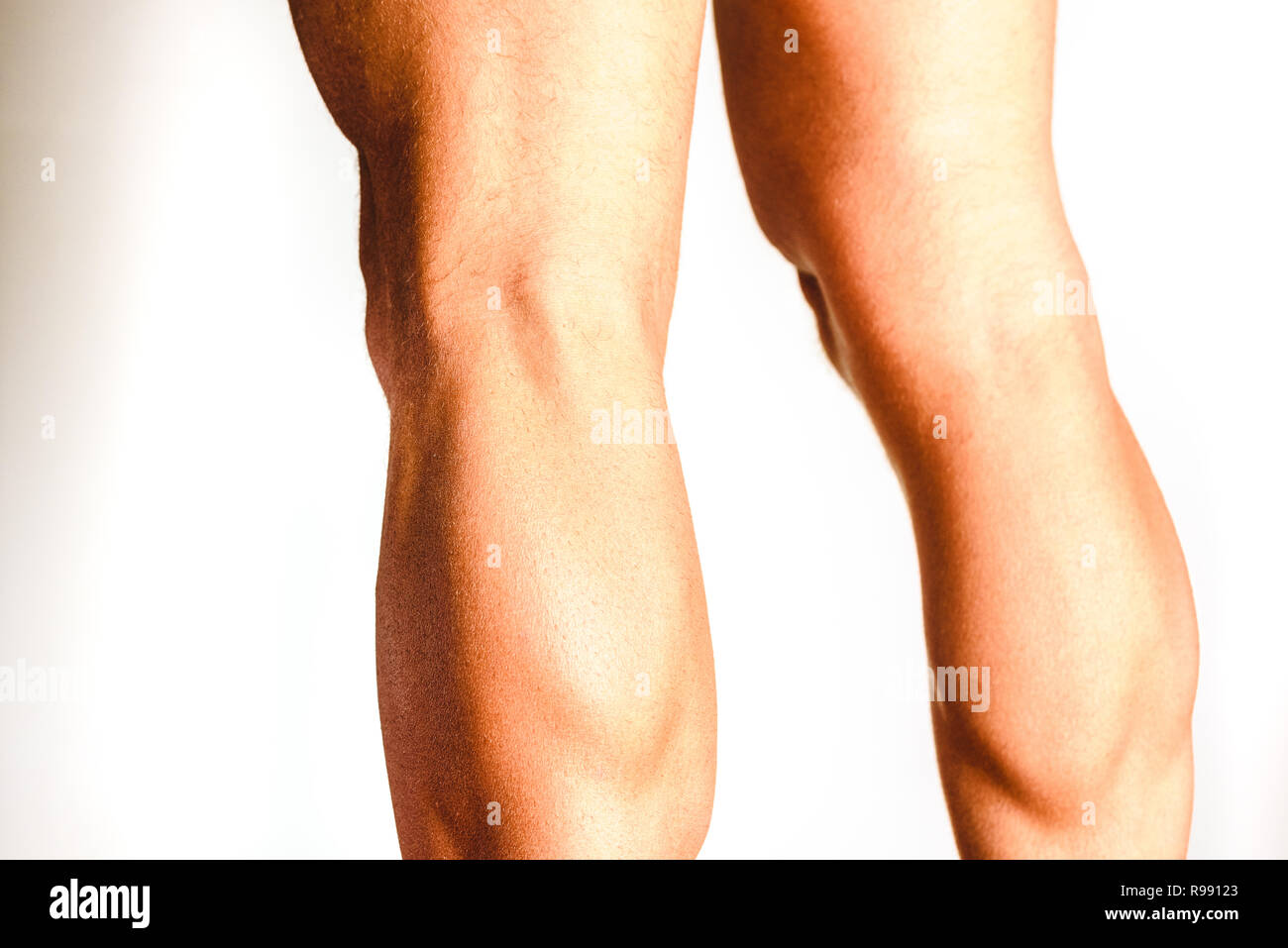 Muscles of the posterior leg, soleus and gastrocnemius muscle, photo of an athlete. Stock Photo