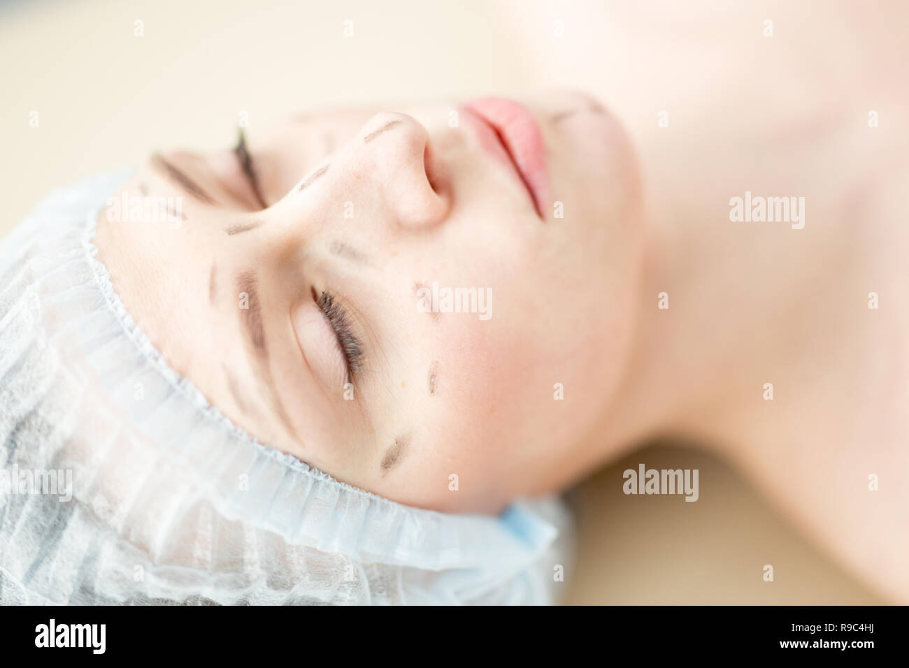 Before plastic surgery Stock Photo