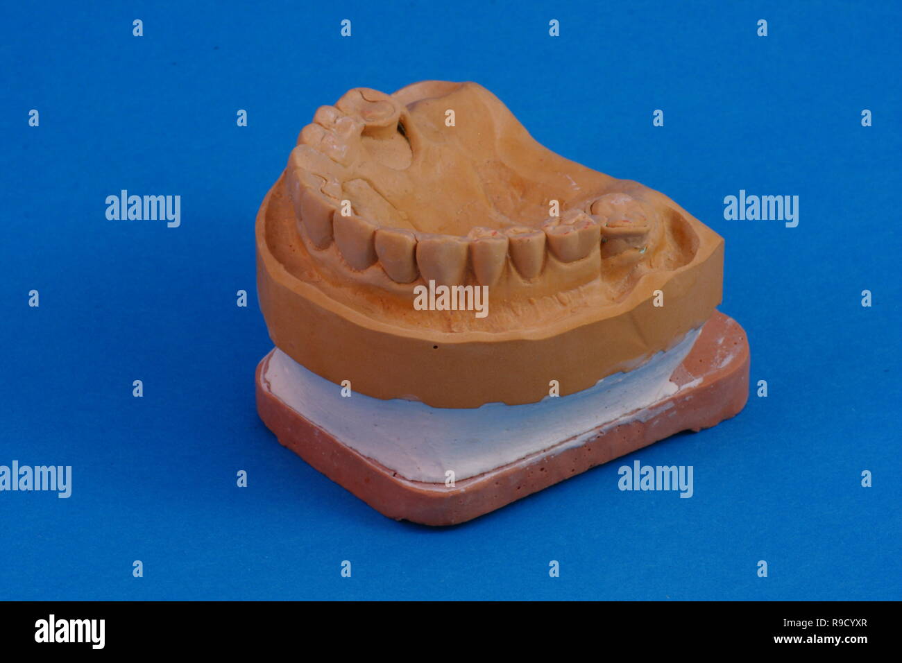 Tooth Working Dental work hi-res stock photography and images - Alamy