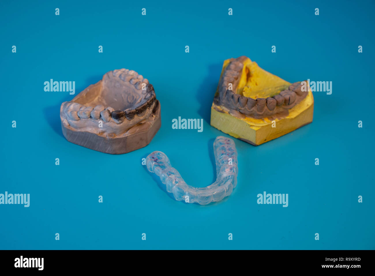 Molds of the jaw. dental splint. Dental implants on blue background