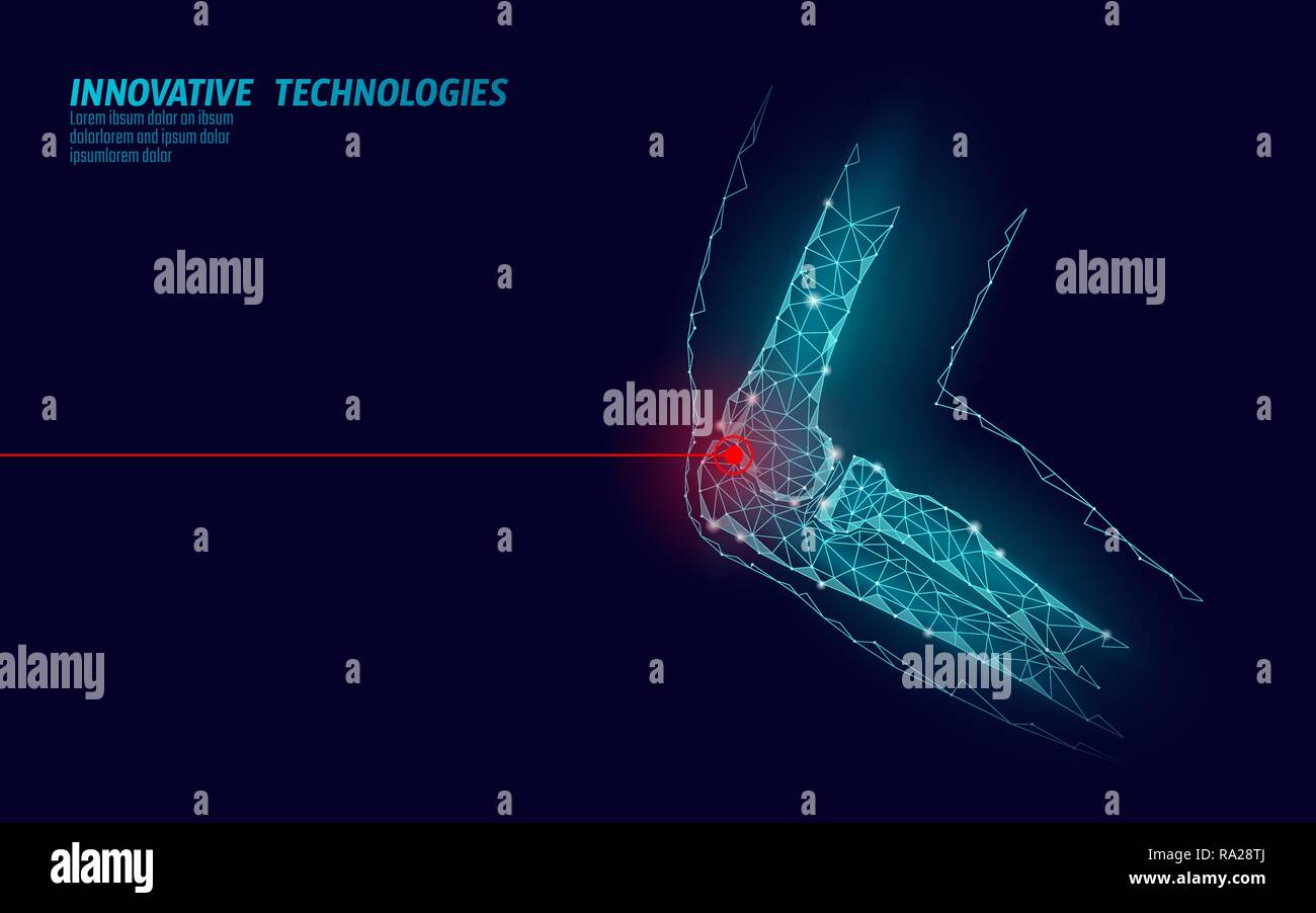 Human elbow joint 3d model vector illustration. Low poly design future technology cure pain treatment. Blue background and red injury man body arm medicine template Stock Vector