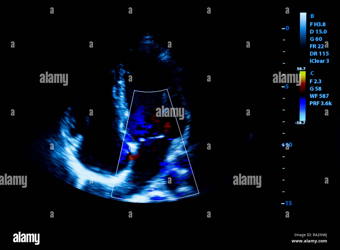 Colourful image of modern ultrasound monitor. Ultrasonography machine