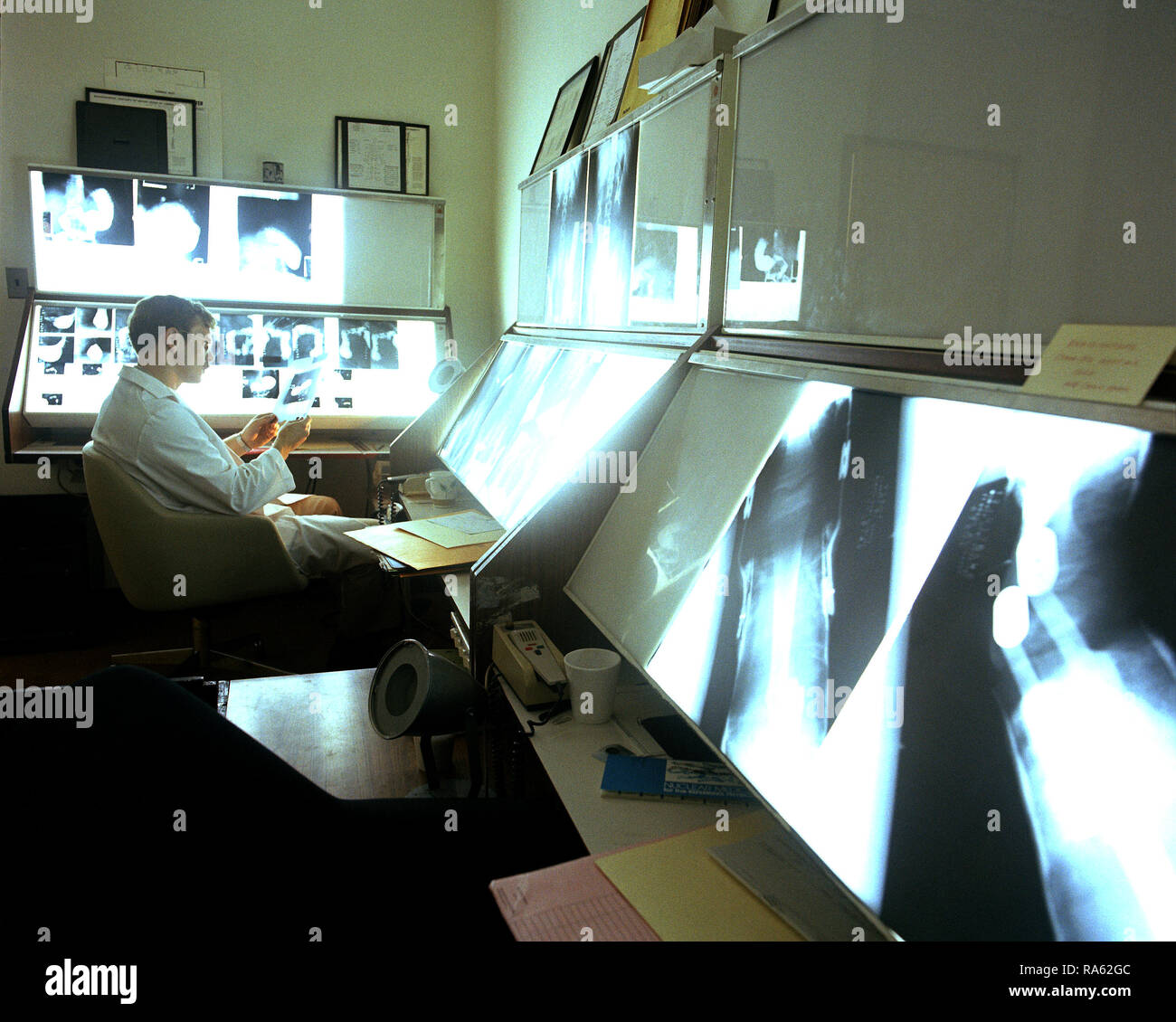 1976 a doctor examines Xrays in the X ray viewing room Stock Photo