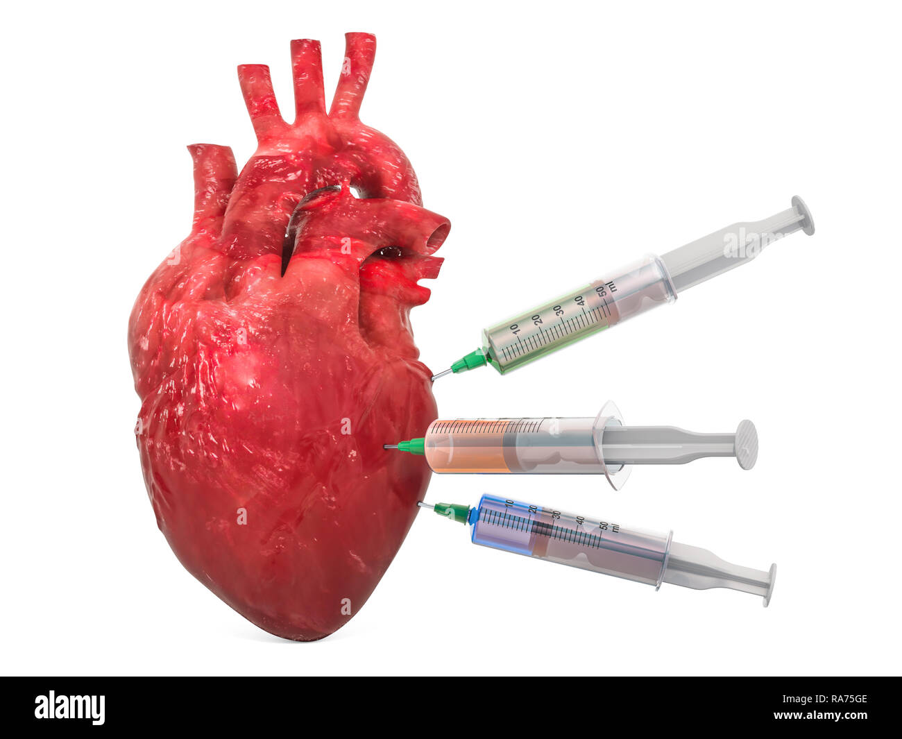 Treatment of heart disease concept, 3D rendering isolated on white background Stock Photo