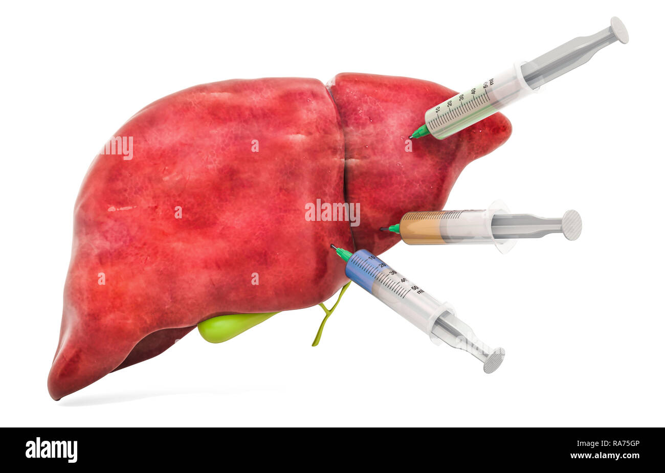 Treatment of liver diseases concept, 3D rendering isolated on white background Stock Photo