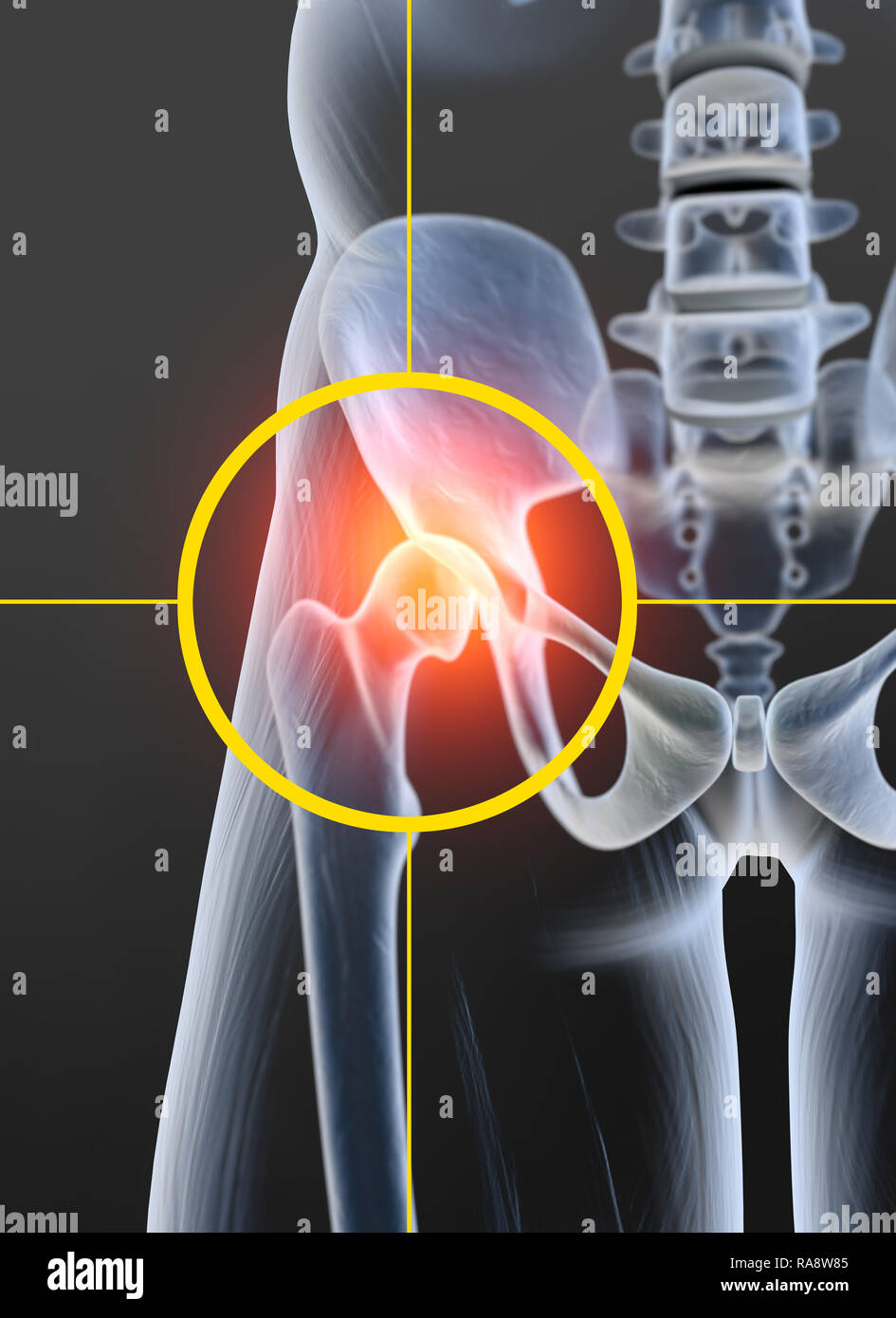 Hip osteoarthritis x ray hires stock photography and images Alamy