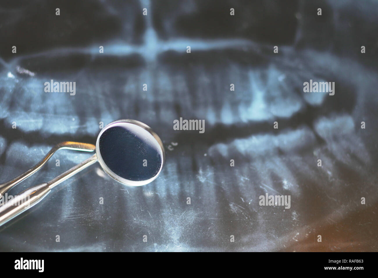 closeup xray of teeth and dental instruments Stock Photo Alamy