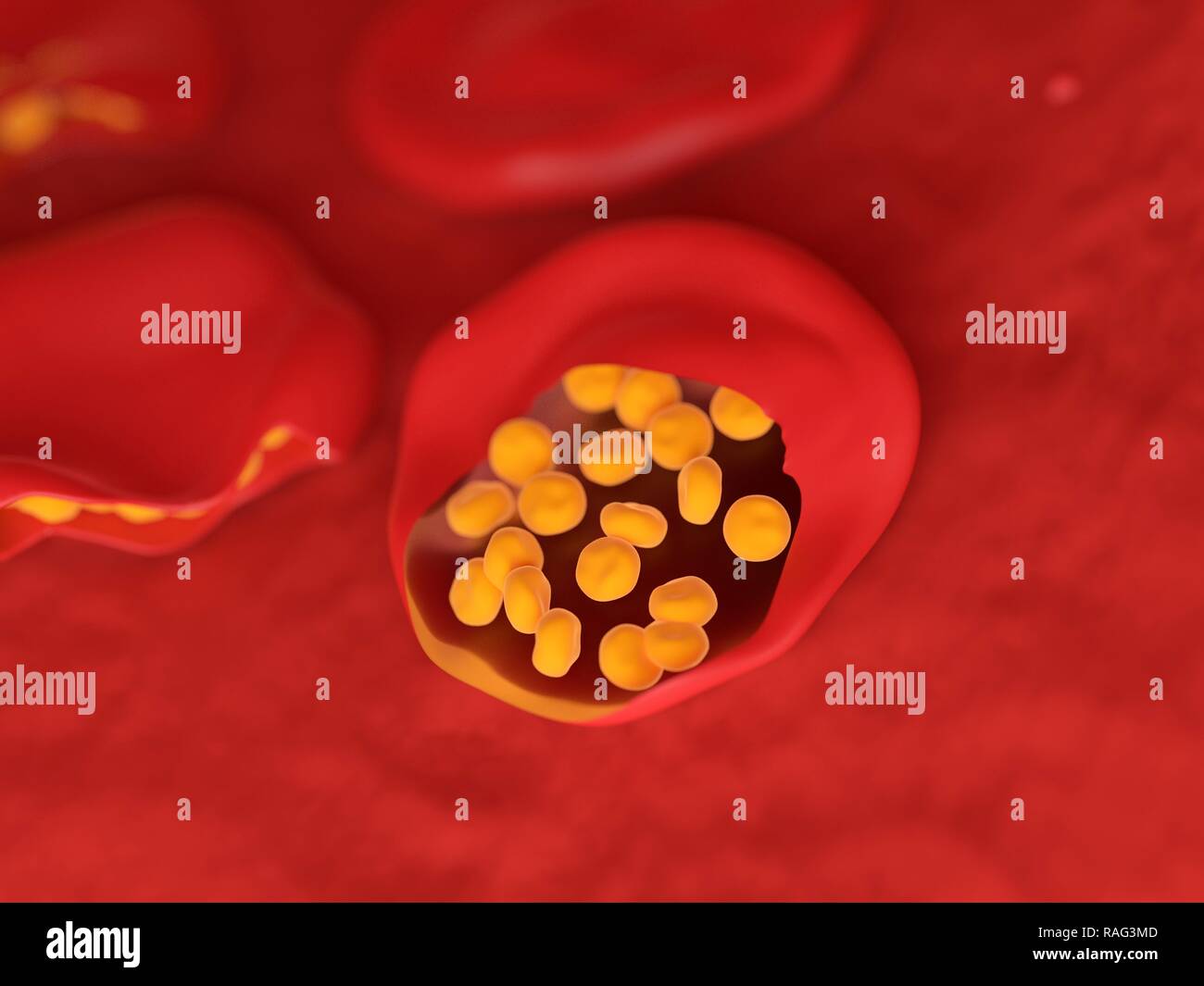 Illustration of malaria infected blood cells. Stock Photo