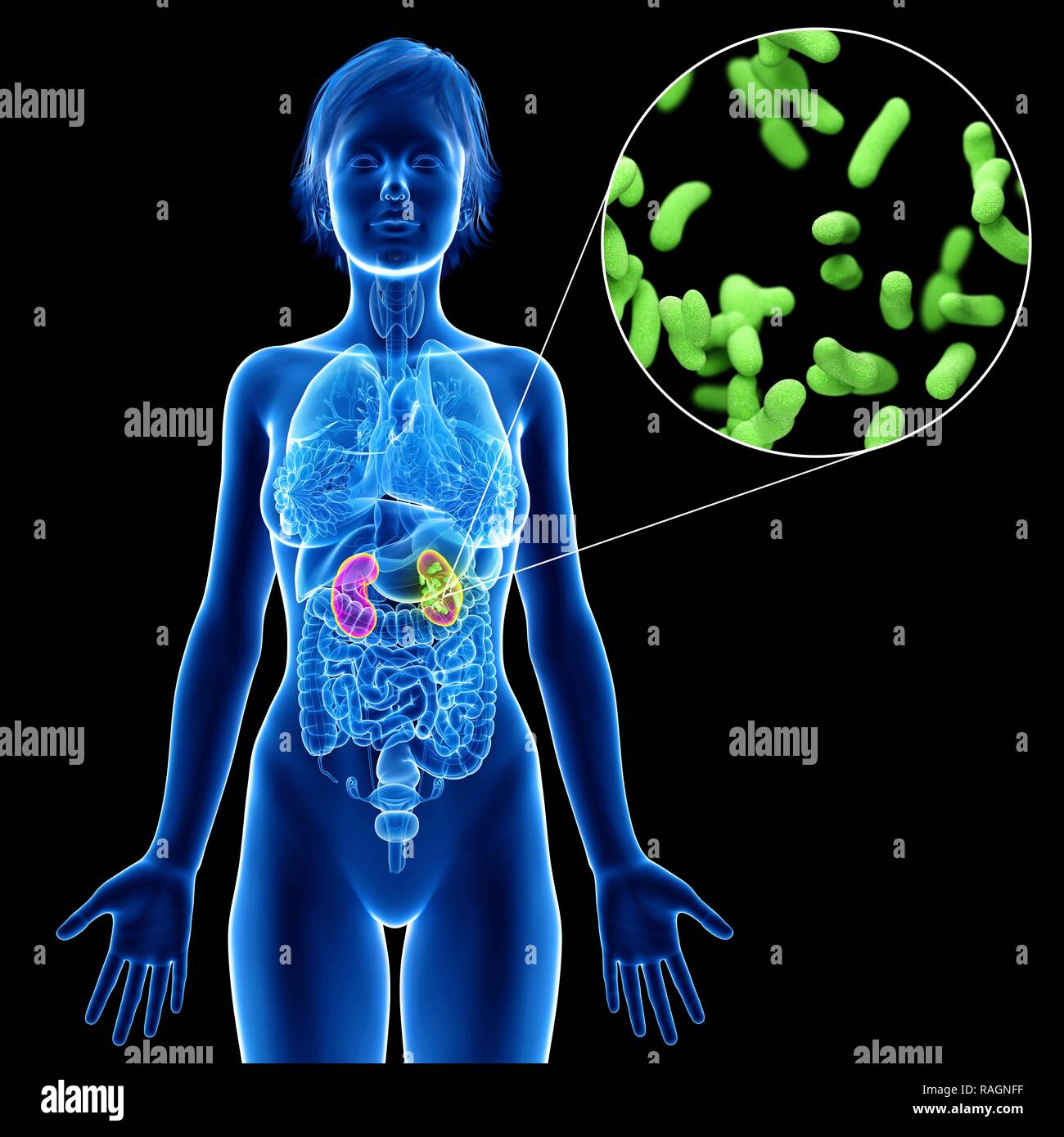 Illustration of a woman's kidney infection Stock Photo Alamy