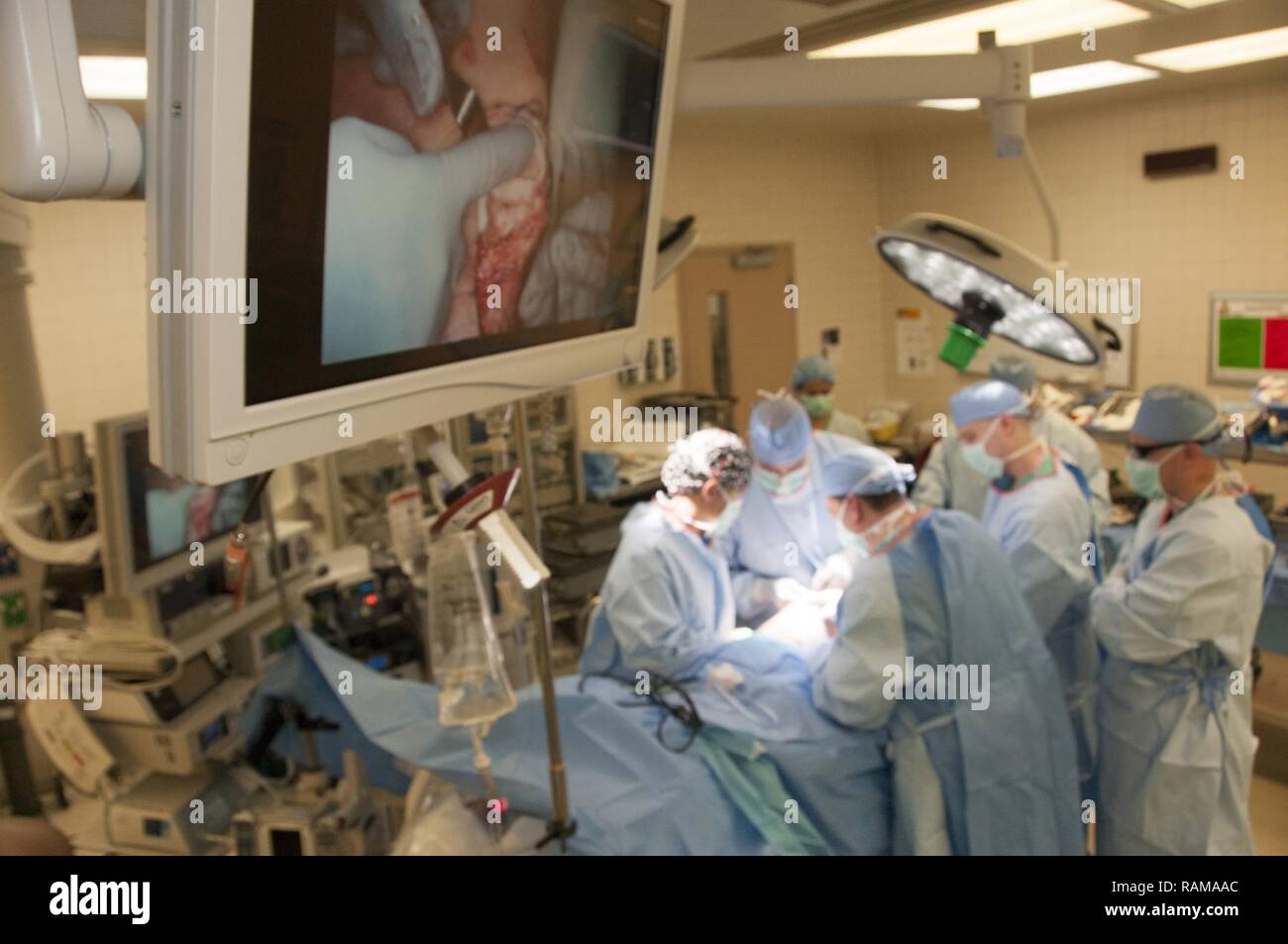 The first knee cartilage surgery using a new implant, a membrane with