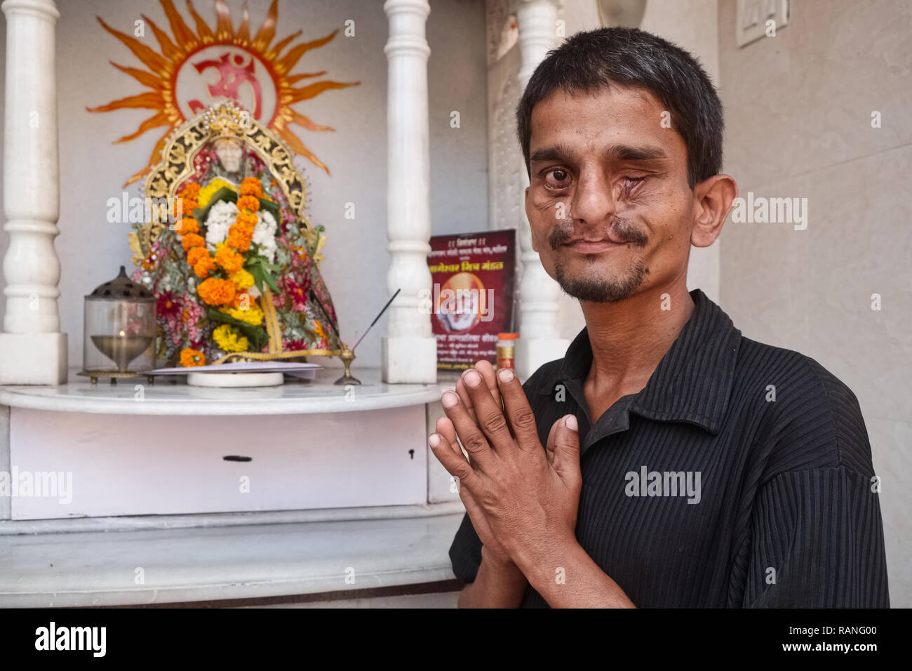 A victim of an acid attack praying at a shrine to Hindu saint Sai Baba, Mumbai, India Stock Photo