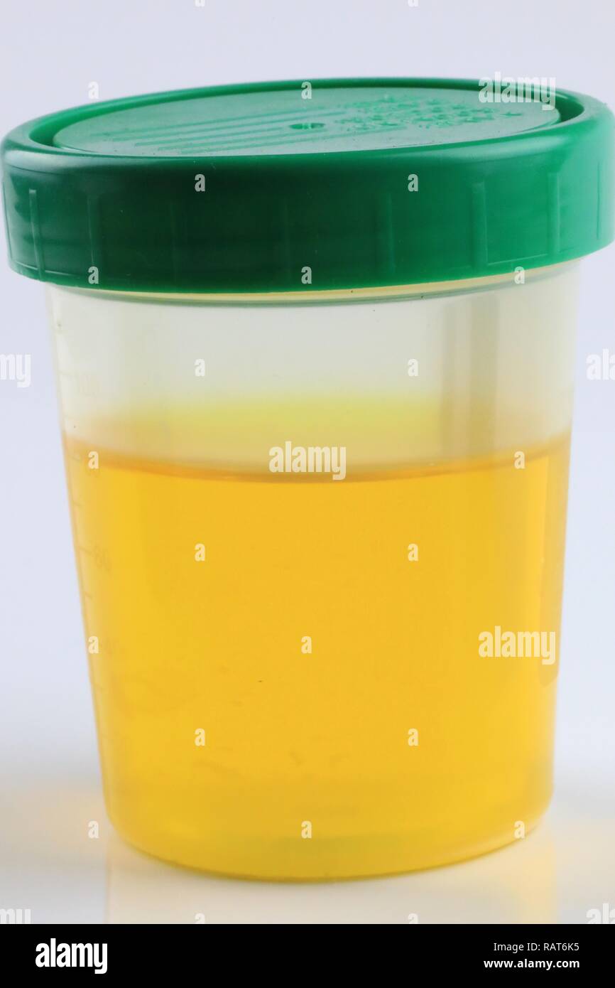 Urine sample for drug and alcohol testing Stock Photo Alamy