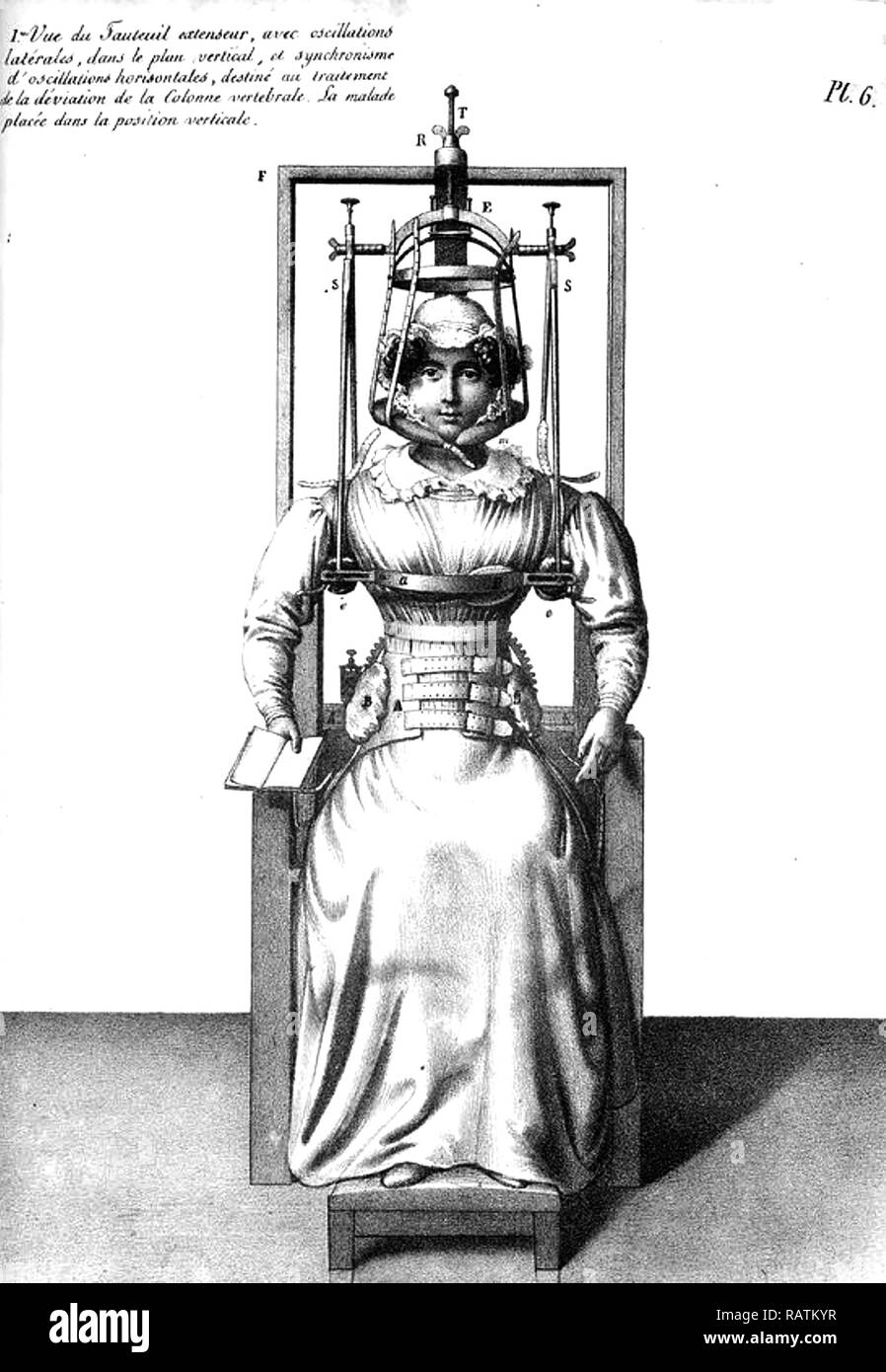 SPINAL CORRECTION in a French book of the 18th century Stock Photo