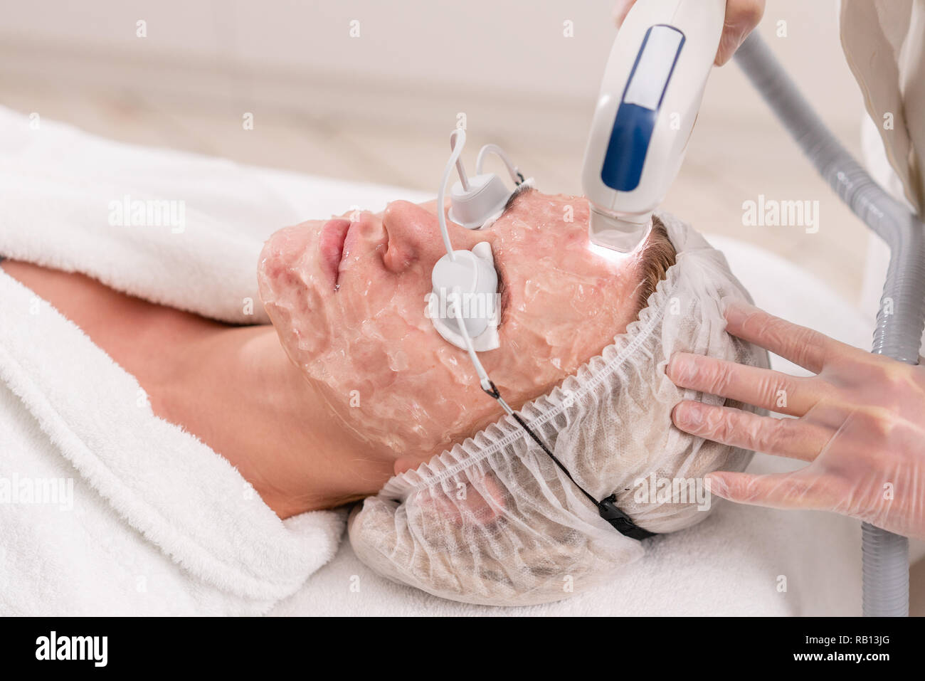 Anti acne phototherapy with professional equipment. Beautiful woman in  beauty salon during photo rejuvenation procedure. Laser face skin treatment  at cosmetic clinic. Hardware cosmetology Stock Photo - Alamy