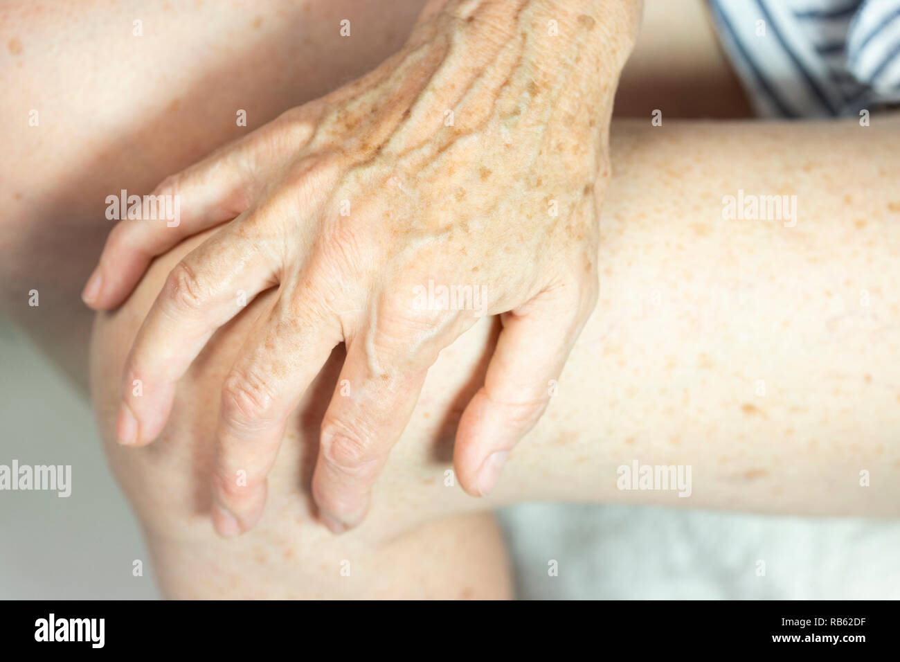 Hand With Spots Of Old Age Stock Photo Alamy