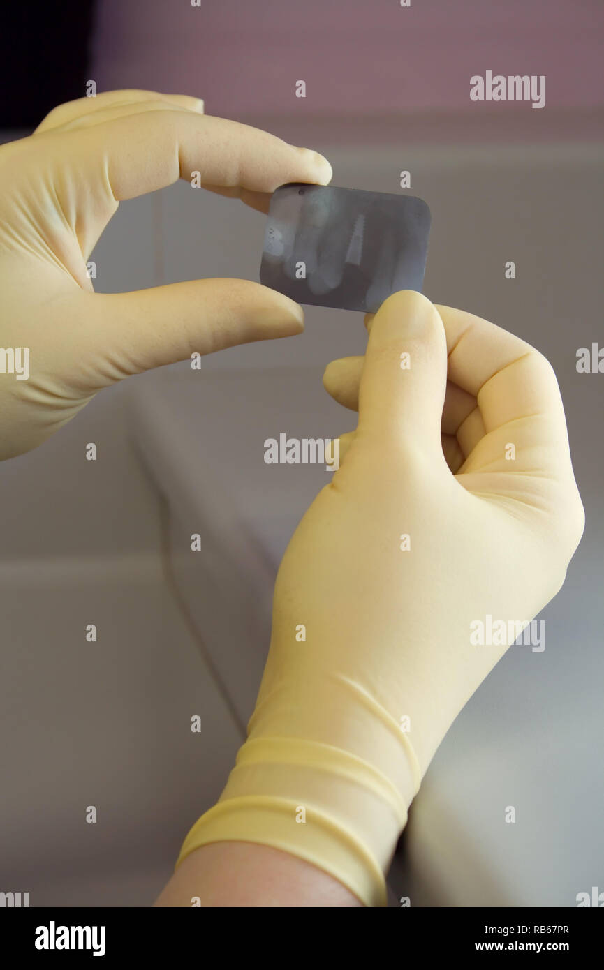 Maze surgery hires stock photography and images Alamy