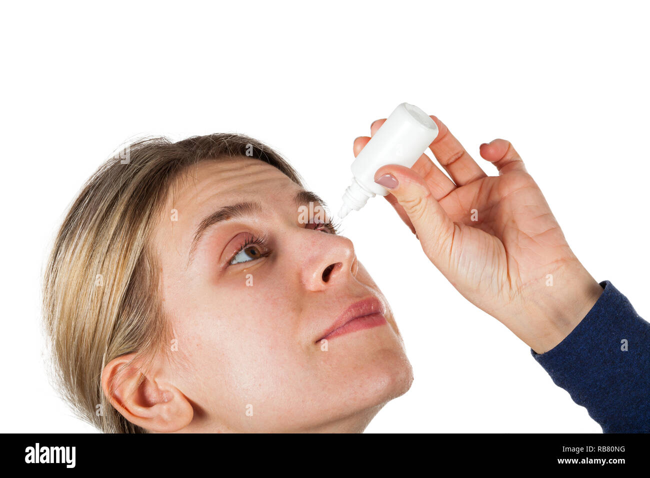 Woman with stye on upper eyelid using medical eye drop on isolated