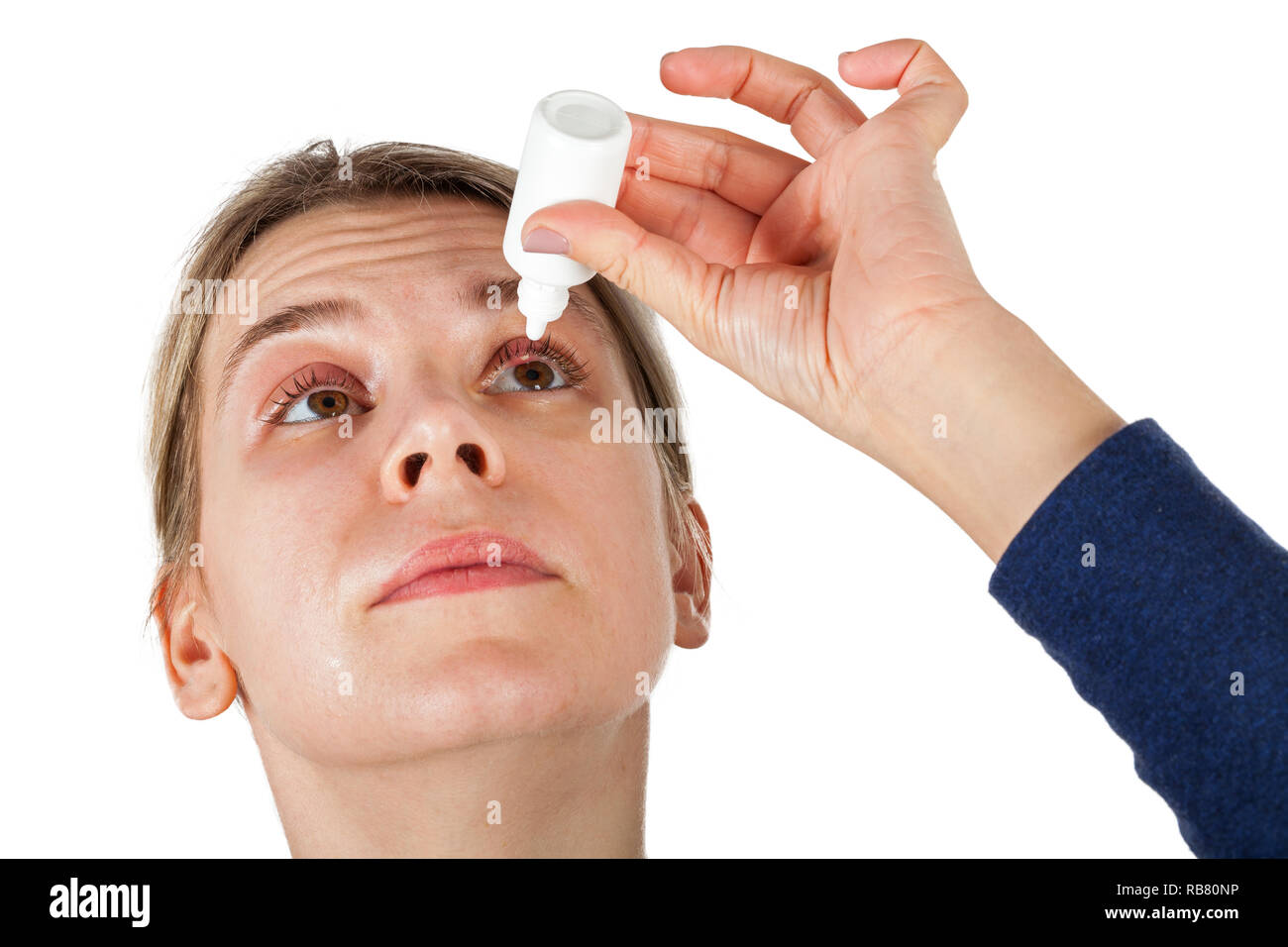 Woman with stye on upper eyelid using medical eye drop on isolated
