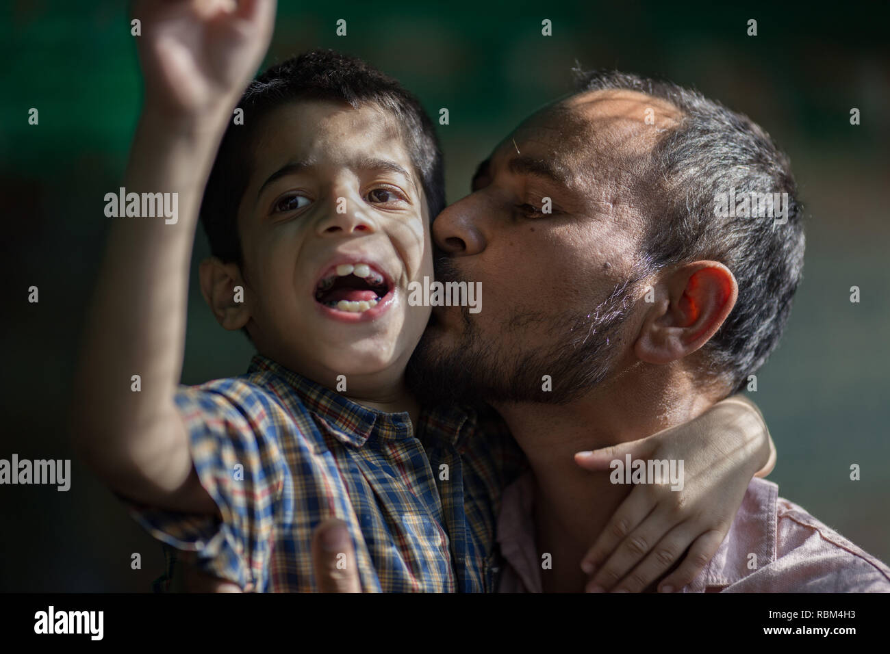 India. 26th Mar, 2017. A father seen embracing his son at Chingari Rehabilitation Center.Chingari cares for victims of the Bhopal Gas Disaster.The Bhopal Gas Disaster was a gas leak incident on the night of 2-3 December 1984 at the Union Carbide plant in Bhopal. Over 500,000 people were exposed to the toxic methyl isocyanate (MIC) gas as they slept. The final death toll is estimated to be between 15,000 and 20,000. Credit: Ryan Ashcroft/SOPA Images/ZUMA Wire/Alamy Live News Stock Photo