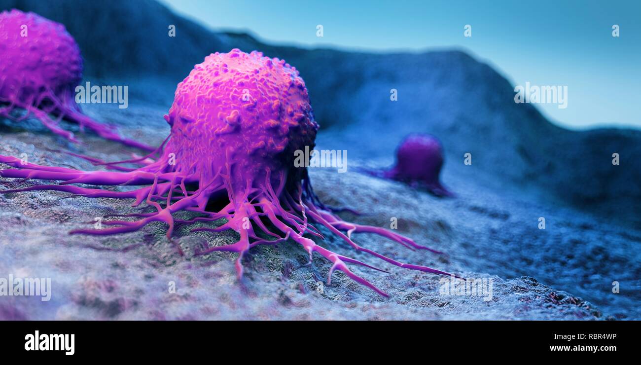 Tumour cancer sem hi-res stock photography and images - Alamy