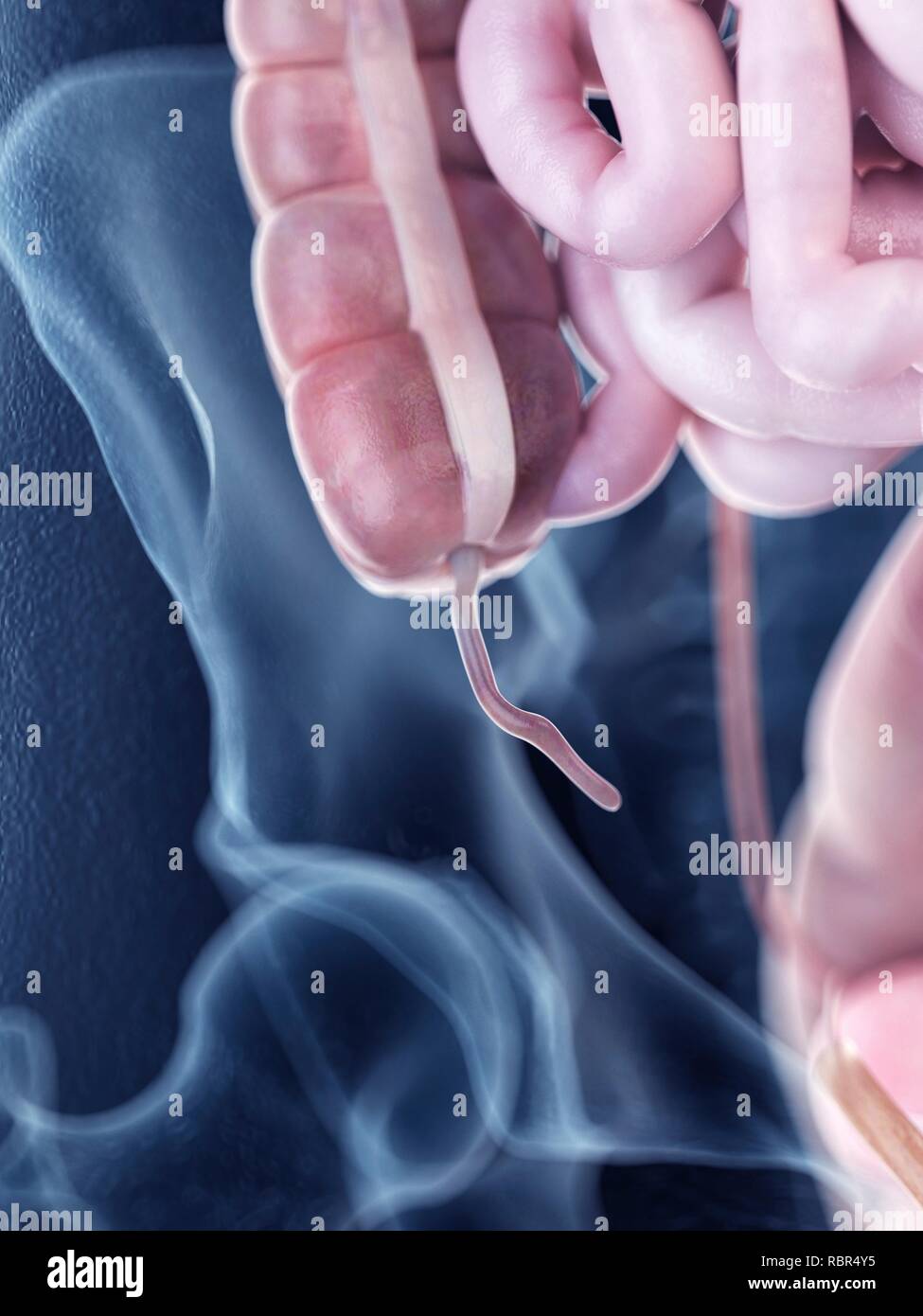 Appendix anatomy hi-res stock photography and images - Alamy
