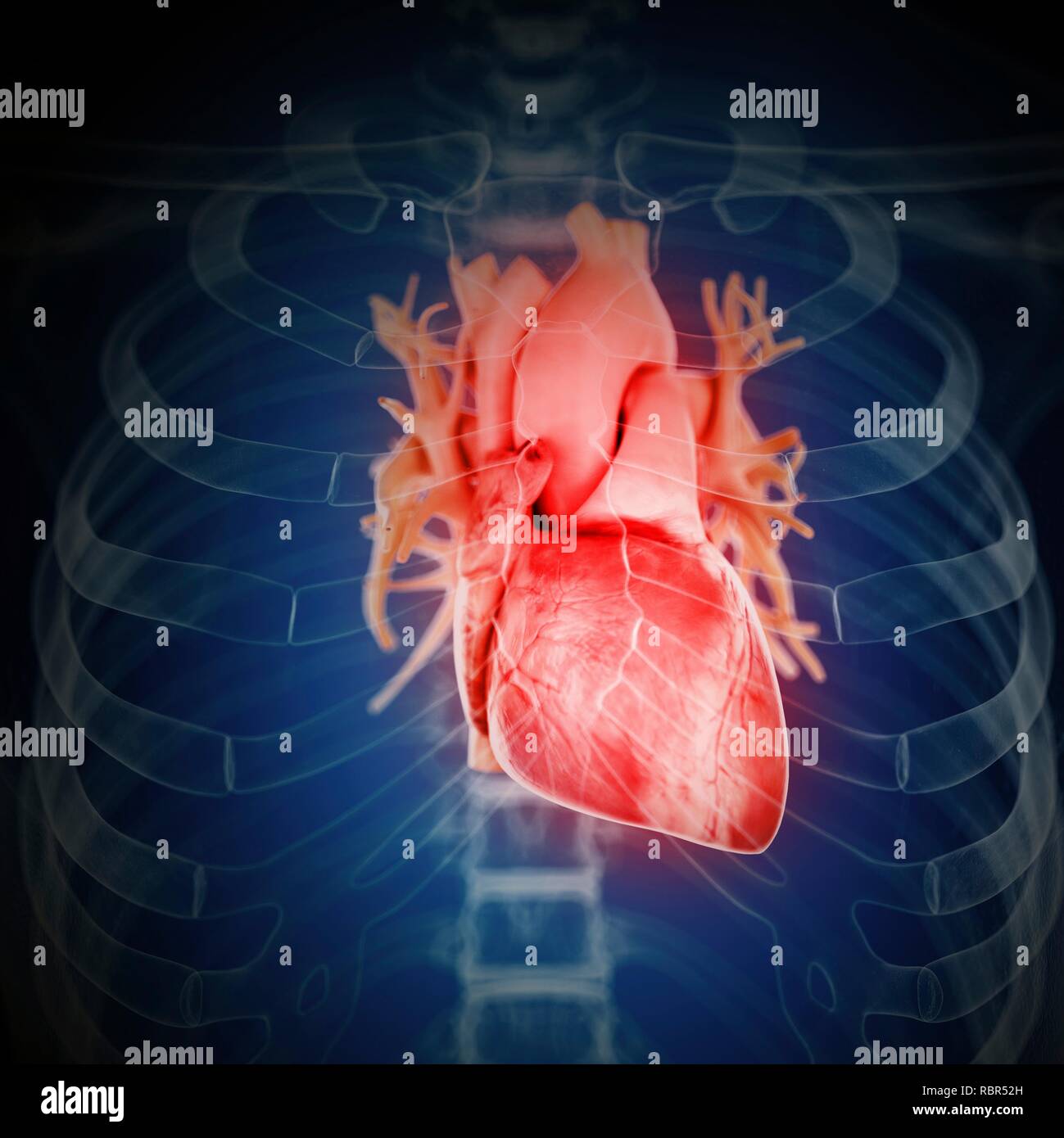 Illustration of an inflamed heart Stock Photo - Alamy