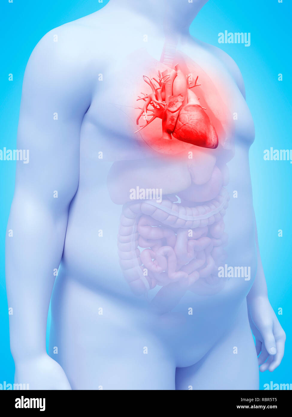 3d human body fat heart hi-res stock photography and images - Alamy