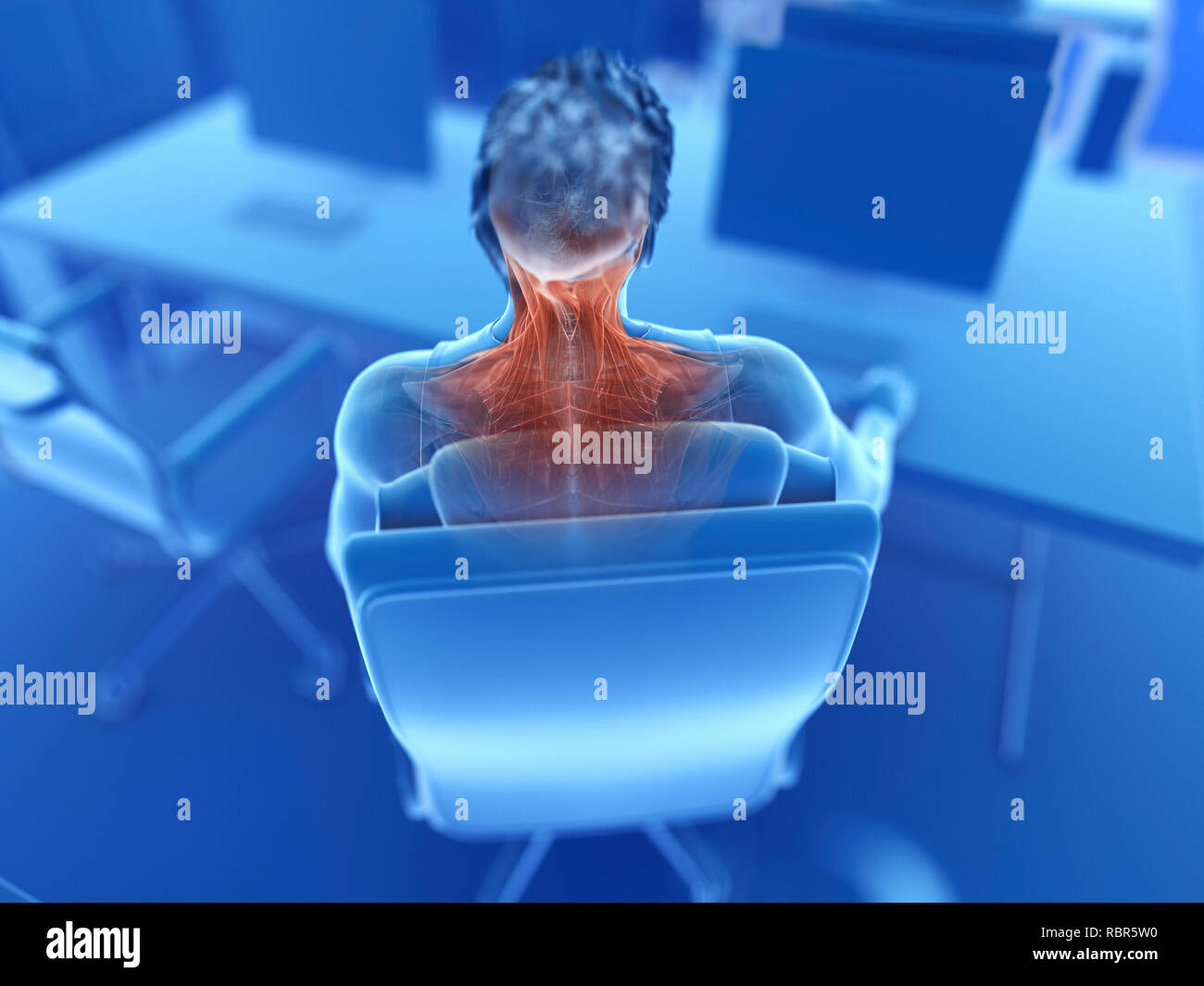 Illustration of an office worker's painful muscles Stock Photo - Alamy