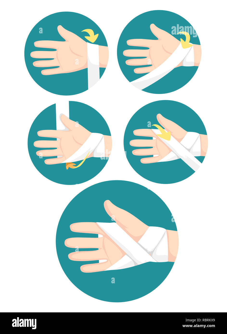 Illustration of Steps How to Apply Bandage Hands as First Aid Training  Stock Photo - Alamy