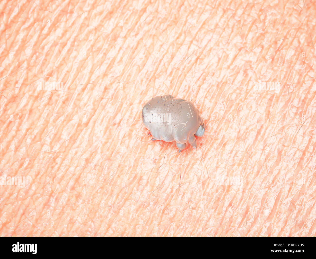 Illustration Of A Scabies Mite Stock Photo Alamy