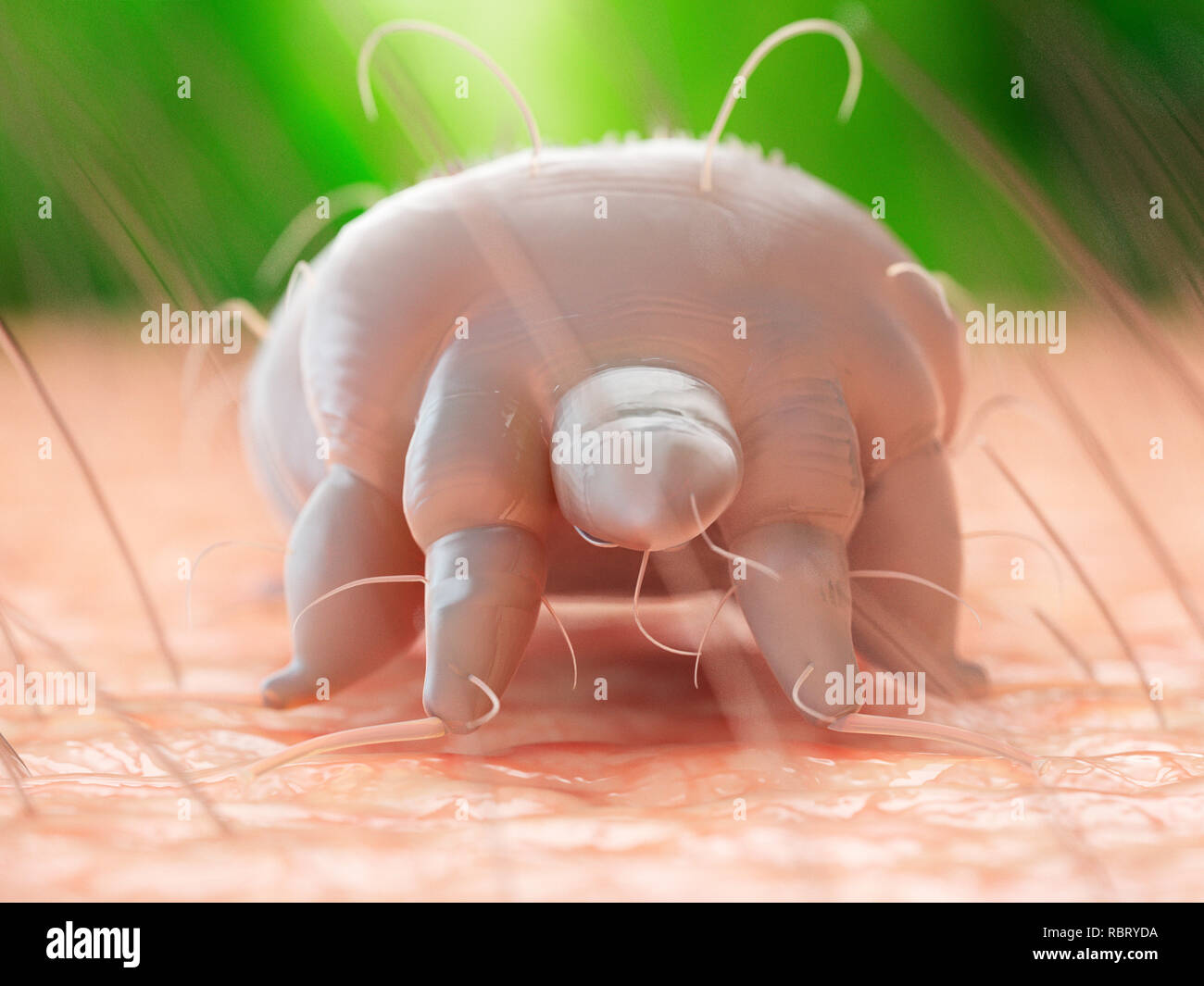 Illustration Of A Scabies Mite On Human Skin Stock Photo Alamy