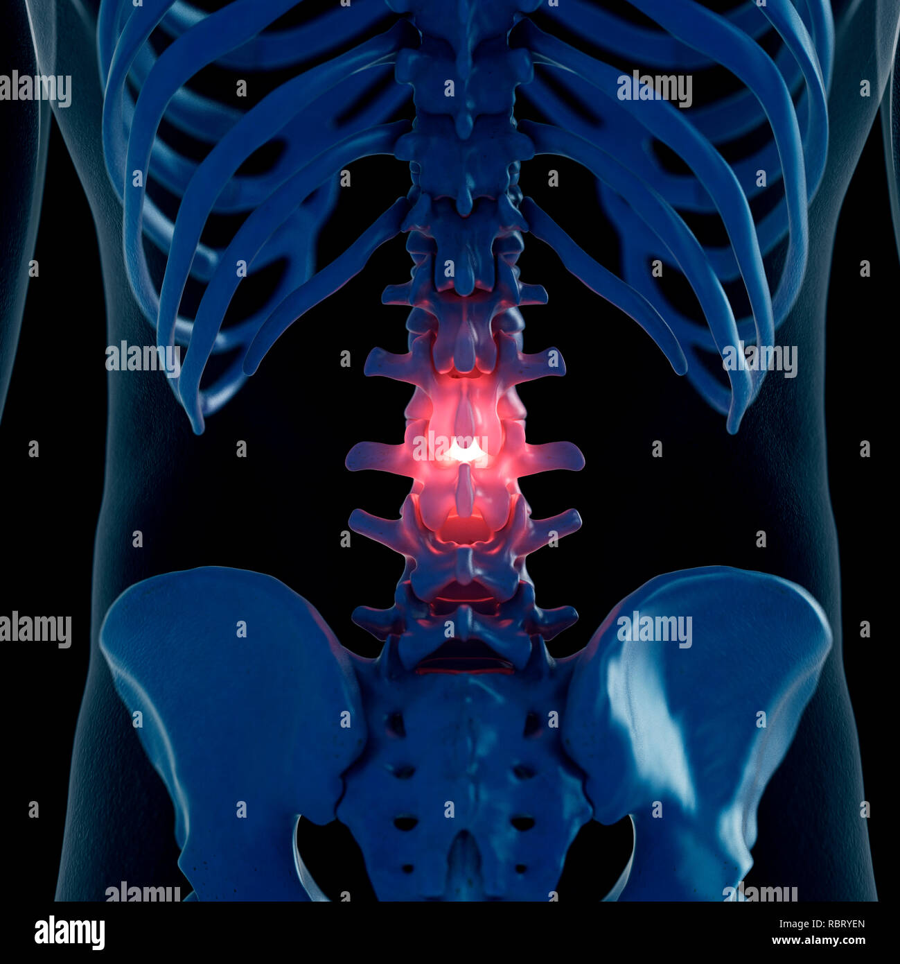 Illustration of a painful lumbar spine. Stock Photo