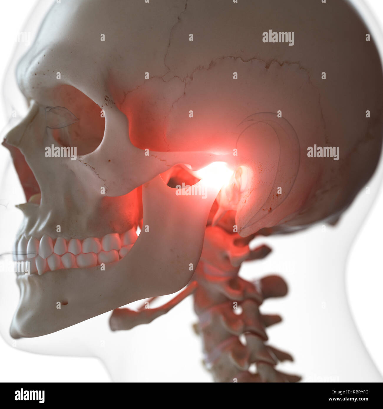 Illustration of a painful temporomandibular joint. Stock Photo