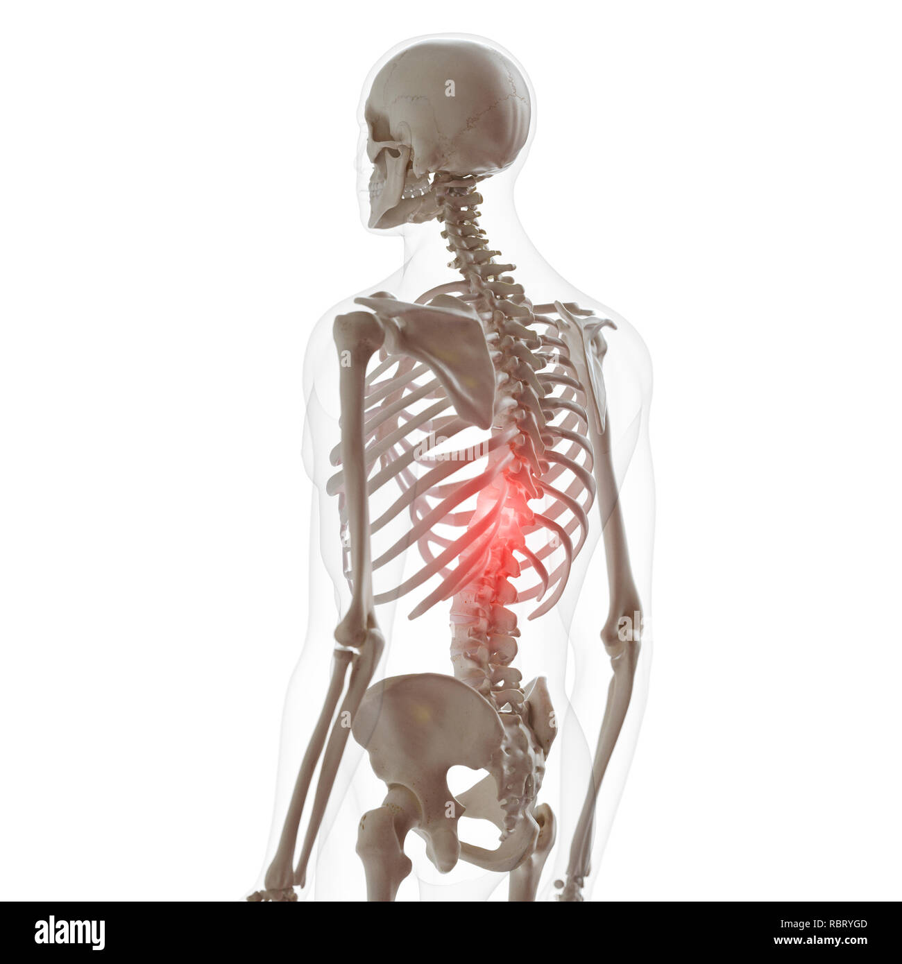 Illustration of pain in the lower spine Stock Photo - Alamy