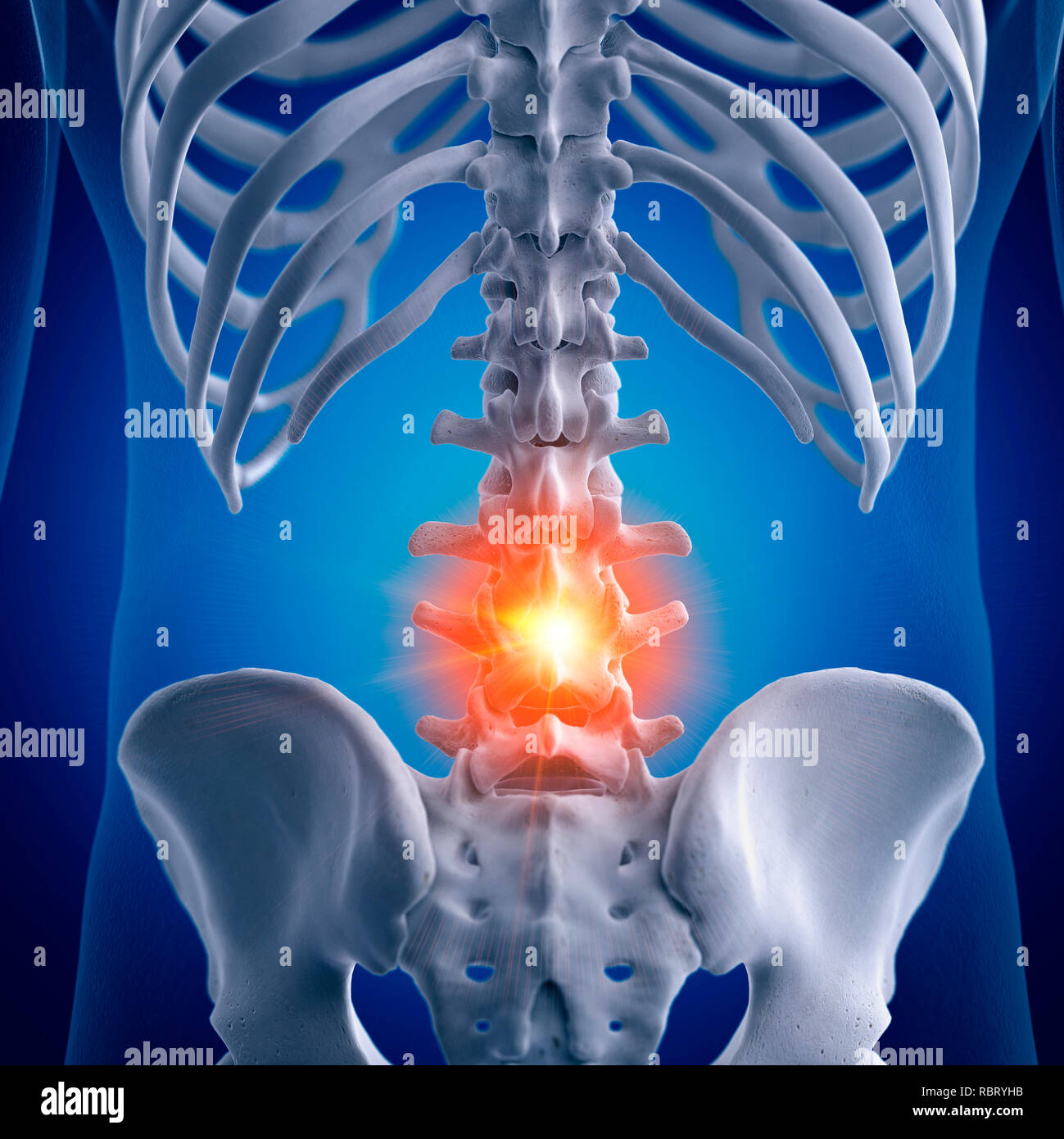 Illustration of a painful lumbar spine Stock Photo - Alamy