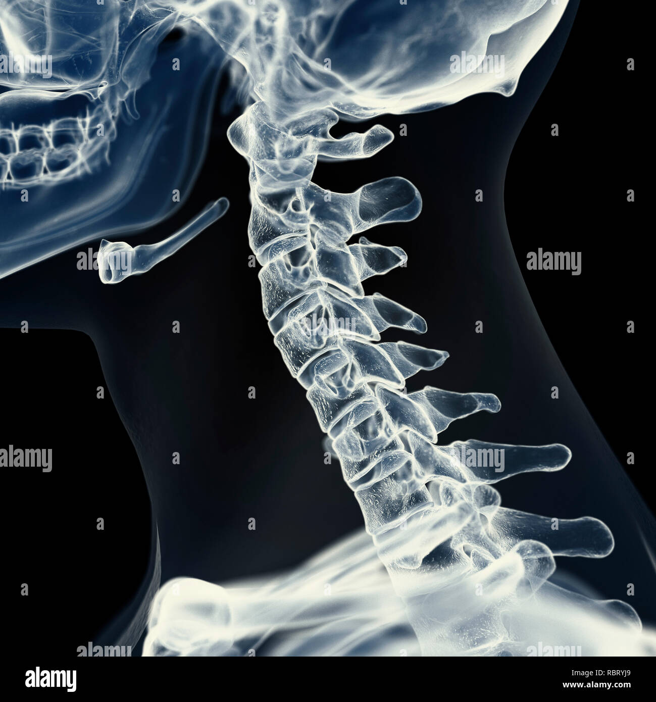 Xray cervical spine hi-res stock photography and images - Alamy