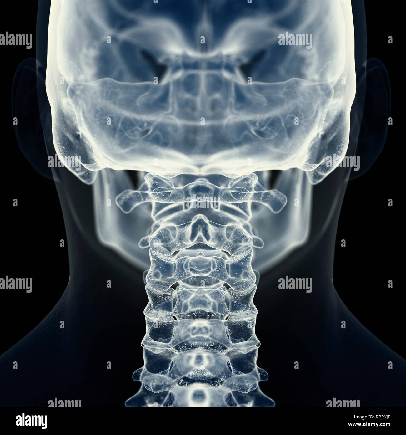 Cervical spine xray hi-res stock photography and images - Alamy