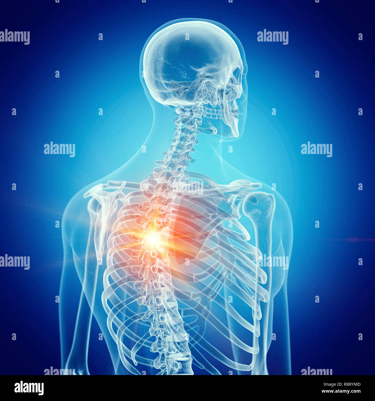 Illustration of backache Stock Photo - Alamy