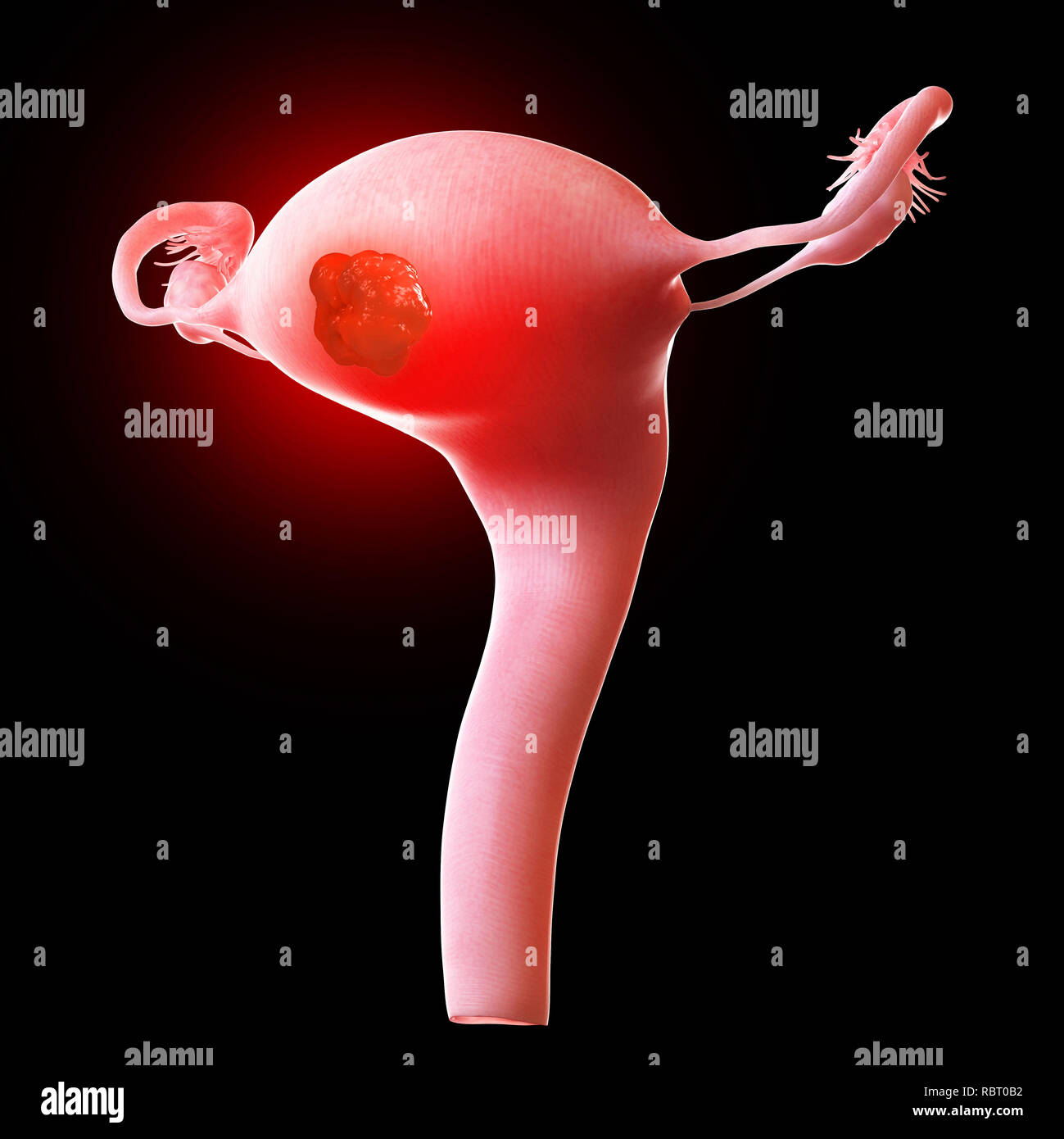 Uterus 3d hi-res stock photography and images - Alamy