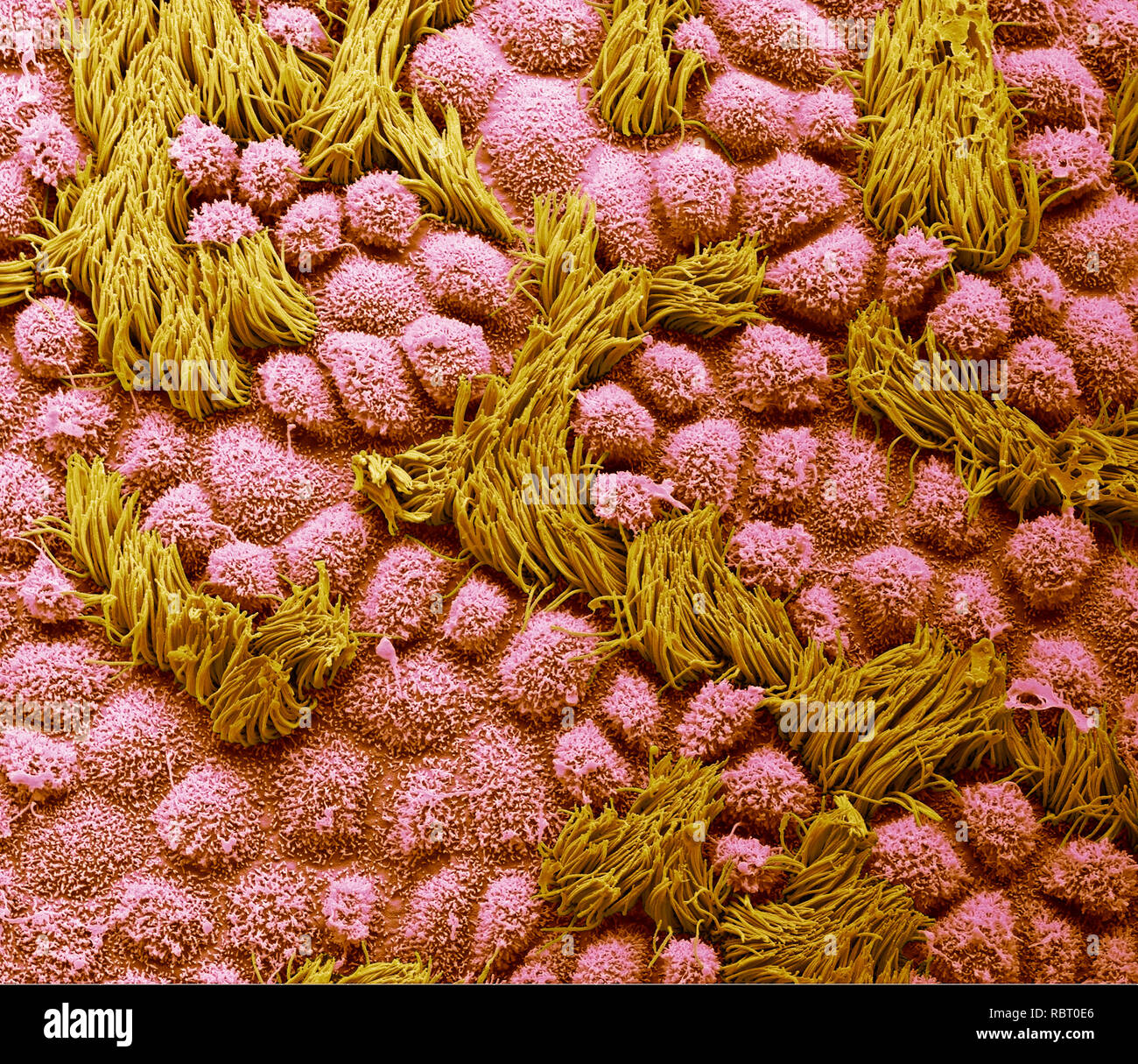 Fallopian tube. Coloured scanning electron micrograph (SEM) of the surface of a human fallopian tube. Fallopian tubes are ducts that lead from the ovaries to the uterus. The epithelium consists of columnar cells, many of which have cilia (yellow). The cilia beat is towards the uterus, aiding transport of the egg from the ovary. Coloured blue are the secretory cells with their microvilli projections. These cells secrete a substance that maintains a moist environment in the tube and may provide nutrients for the egg. Magnification: x2000 when printed at 10 centimetres wide. Stock Photo