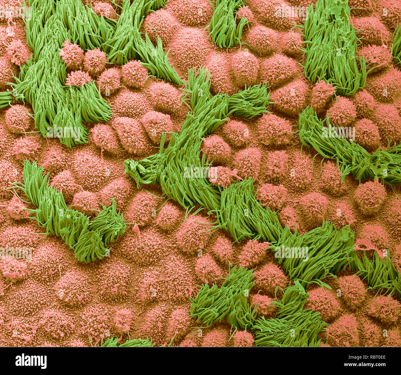 Fallopian tube. Coloured scanning electron micrograph (SEM) of the surface of a human fallopian tube. Fallopian tubes are ducts that lead from the ovaries to the uterus. The epithelium consists of columnar cells, many of which have cilia (green). The cilia beat is towards the uterus, aiding transport of the egg from the ovary. Coloured blue are the secretory cells with their microvilli projections. These cells secrete a substance that maintains a moist environment in the tube and may provide nutrients for the egg. Magnification: x2000 when printed at 10 centimetres wide. Stock Photo