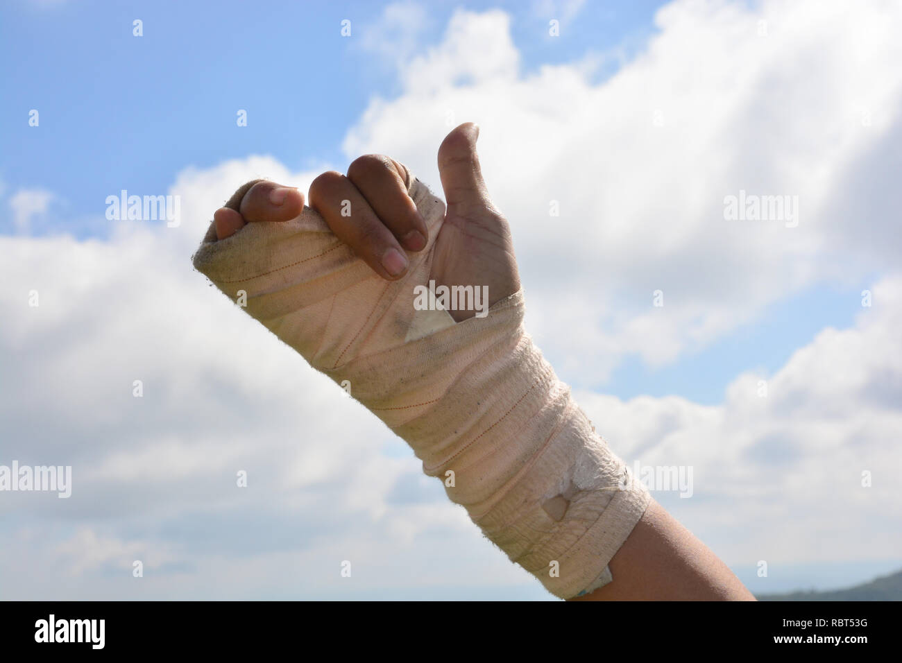 elastic finger bandage