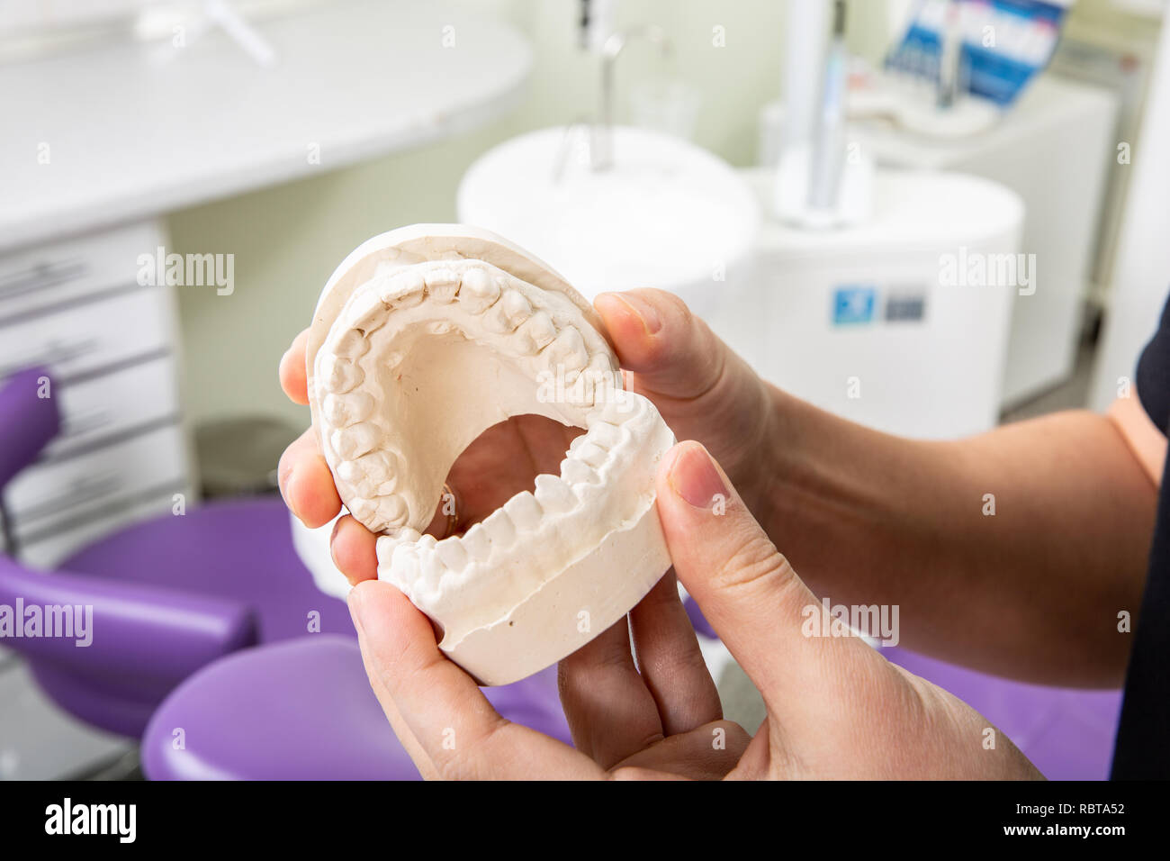 Gypsum model of jaw with teeth in in the hands of a dentist Stock Photo