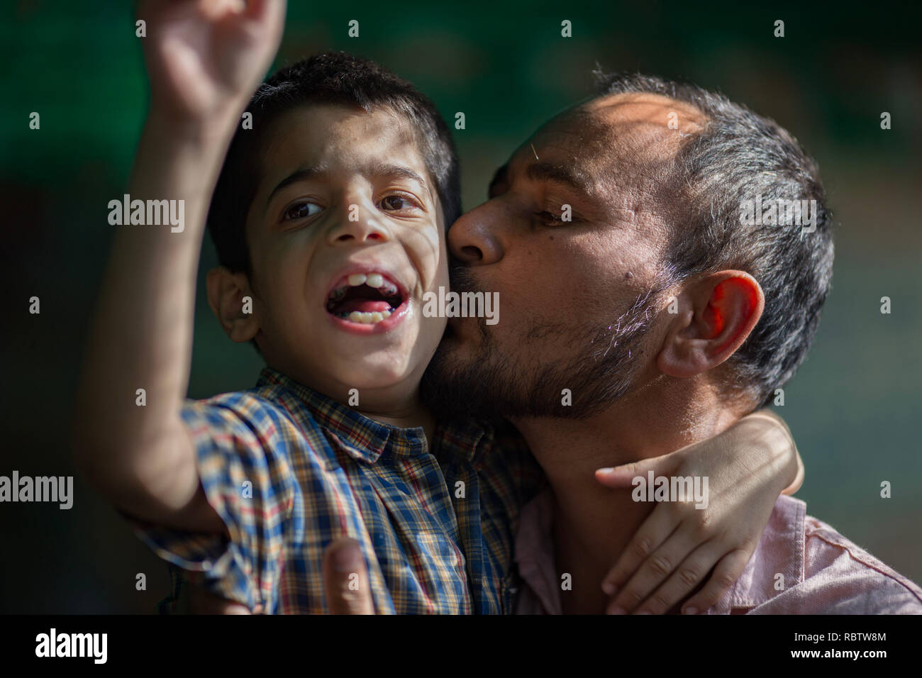 A father seen embracing his son at Chingari Rehabilitation Center. Chingari cares for victims of the Bhopal Gas Disaster. The Bhopal Gas Disaster was a gas leak incident on the night of 2-3 December 1984 at the Union Carbide plant in Bhopal. Over 500,000 people were exposed to the toxic methyl isocyanate (MIC) gas as they slept. The final death toll is estimated to be between 15,000 and 20,000. Stock Photo