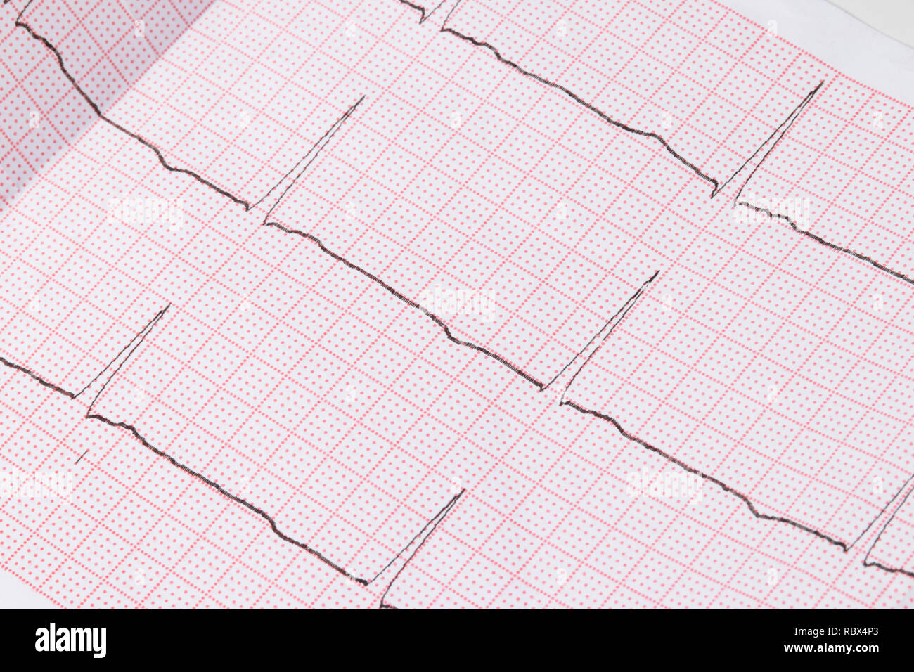 Ekg electrocardiogram blue hi-res stock photography and images - Alamy