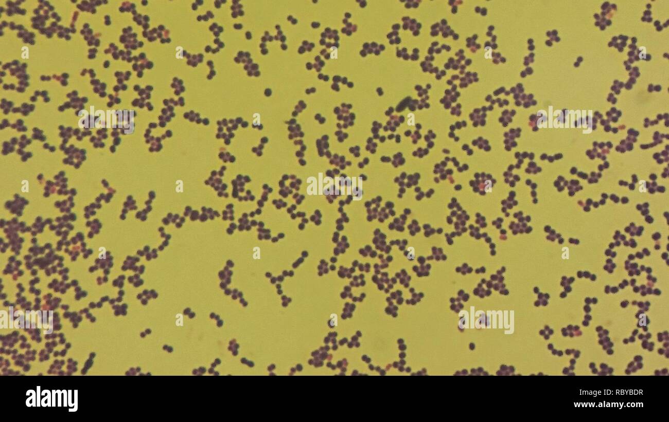 Aerococcus urinae microscopy stock photo alamy