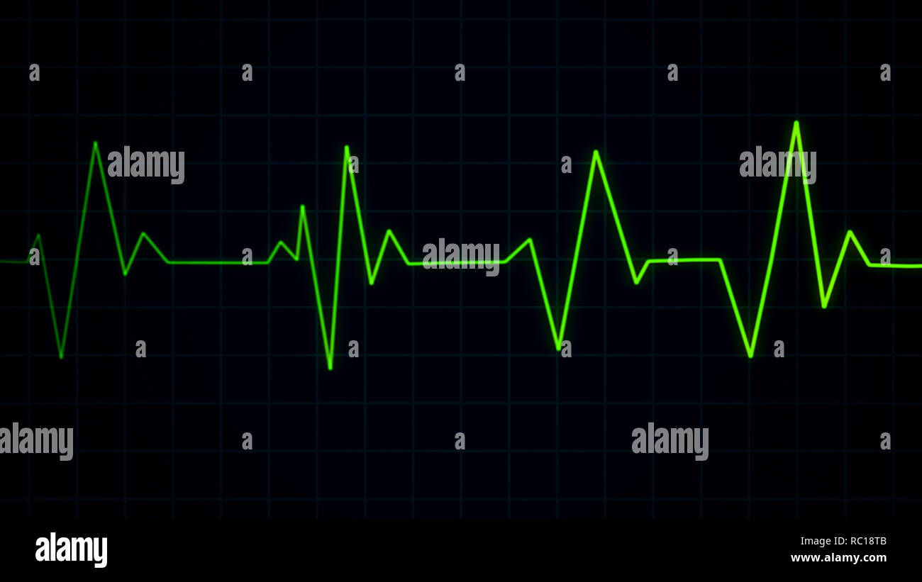 Green heartbeat pulse on cardiogram screen, EKG ECG cardio healthcare