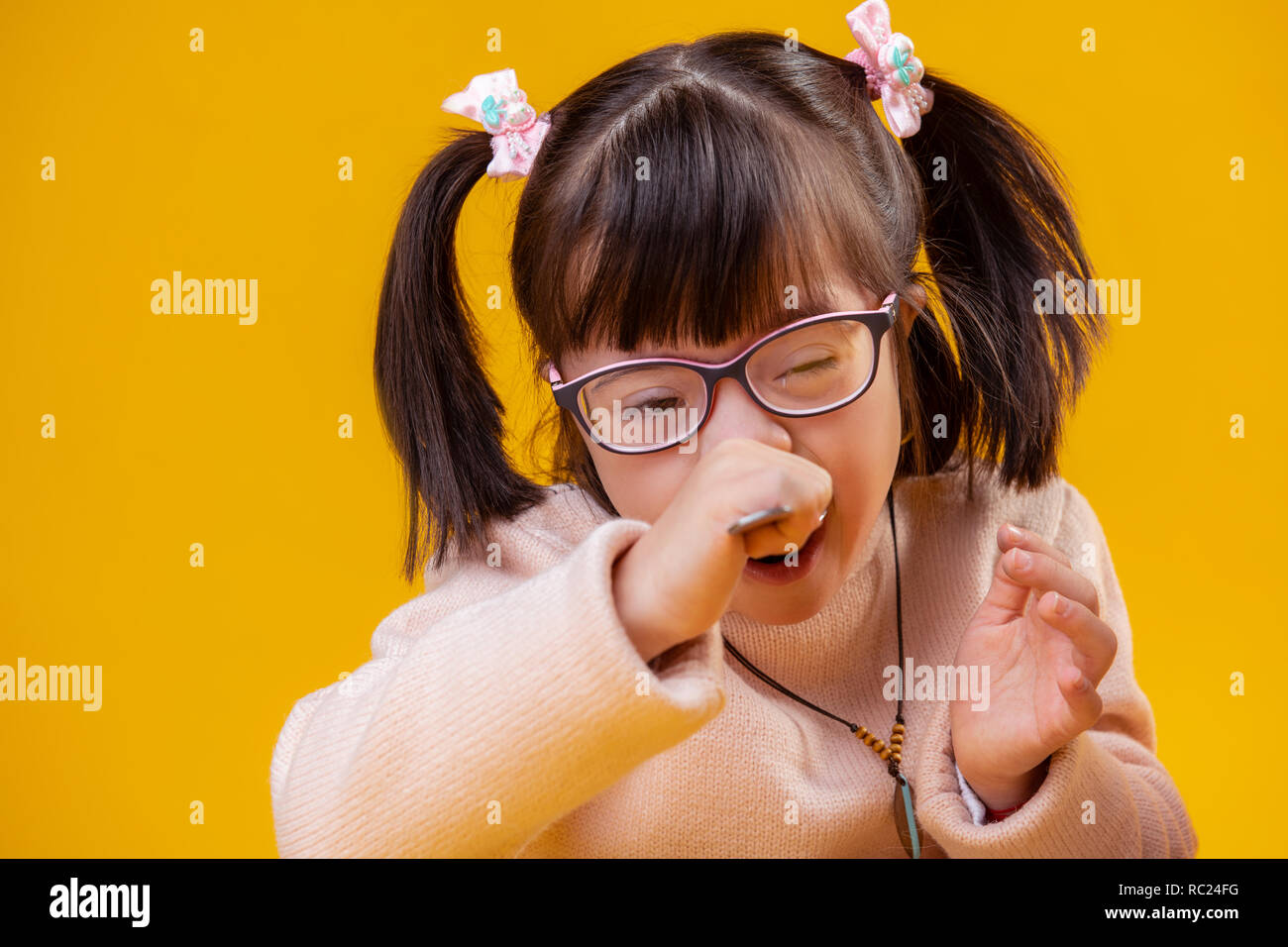 Extraordinary little girl with down syndrome having unusual face features Stock Photo