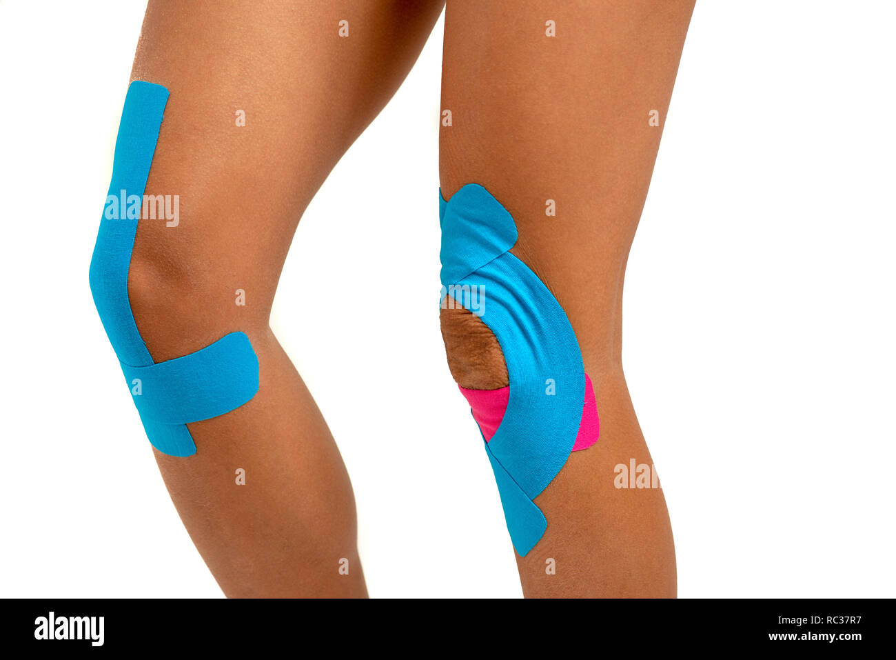 Kinesio hi-res stock photography and images - Page 11 - Alamy