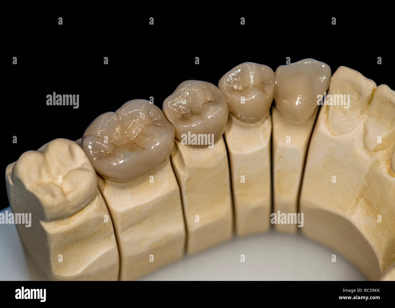 Ceramic zirconia teeth Stock Photo Alamy
